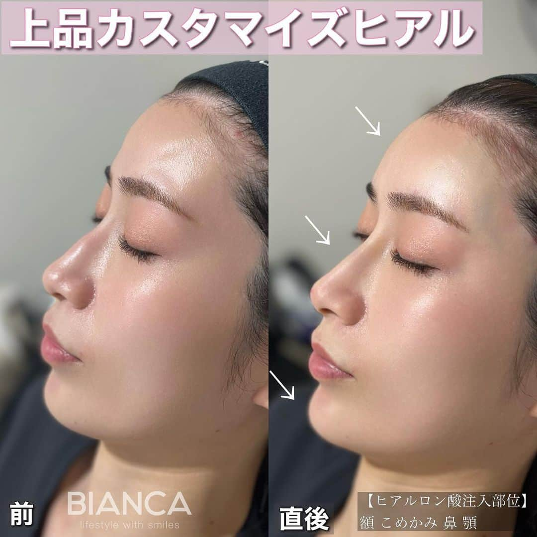 辻沢由有（BIANCA CLNIC 表参道院 院長）のインスタグラム