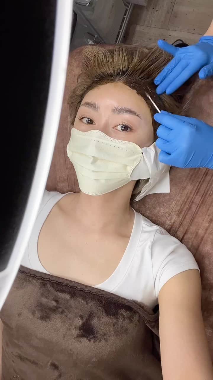 &mのインスタグラム：「担当🤍三浦さん @medicalbrows_miura  2.3年ぶりくらいにヘアラインのアートメイクをしてきたよ🤍最近やりたすぎて1年くらい探してたからこちらに出会えて幸せでした☺️ 担当してくださった三浦さんが、とても手際よく且つ美的センス抜群で、わたしが口出す場面なしでした🙃おでこの生え際で印象がかなり変わるから、第一印象もこれでばっちりでしょ🤭 次回また2ヶ月後が楽しみ👄仕上がり大満足🤍ありがとうございました🤍   🤍APP DLお友達紹介キャンペーン🤍 フォロワーさんにお得なお知らせです！ ご来院の際に、私の会員番号【2004969808743】をお伝えすれば、2023年6月末までの期間限定で、当日使用できる『9,000円分』のポイントをプレゼントしてくれるそうです🤍 友人紹介制度の詳細は公式アカウントのハイライトや投稿から確認してね🤍  @medicalbrows またなんと「メディカルブロー」から⾝近な価格帯のセカンドライン『easy brows』が誕生したみたいです！ なんと平日モニターなら眉、リップ共に1回4万円で受けられてしまうなんてビックリ🫢  しかも施術アーティストはメディカルブローと同じ !! だから6Dストローク技術で自然な毛並みデザインアートメイクをやっていただけます。 “一度試しに受けてみたい、もっと安かったらうけてみたい”と思ってる方はぜひ🤍 詳細はタグから見てね！  メディカルブロー：@medicalbrows ご来院クリニック：@medicalbrows_omotesando  担当者：@medicalbrows_miura イージーブロー：@easy_brows__  メディカルブロー：@medicalbrows ご来院クリニック：@medicalbrows_omotesando  担当者：@medicalbrows_miura イージーブロー：@easy_brows__  #medicalbrows #メディカルブロー #メディカルブロー表参道院 #アートメイク東京 #アートメイク #メディカルアートメイク #6Dストローク #眉アートメイク #毛並みアートメイク #ヘアライン #ヘアラインアートメイク #イージーブロー #easybrows #アートメイクを身近に」