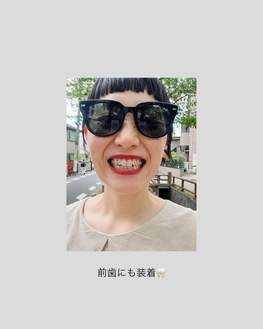 Chocolatさんのインスタグラム写真 - (ChocolatInstagram)「歯列矯正のあと、ヘアカットへ。  ついに上の前歯にも矯正器具を装着。歯の痛みでぼーっとしますが、少しずつ前進です。  どうもありがとうございました🙏  ✂︎ @kaori_negoro_anti   🦷 @omotesando_dental_office   4/26（水）21:00からコルチェア @corchea_tokyo 新作イヤリングの販売があります。 詳細はひとつ前の投稿をご覧くださいね👀 ・ ・ #歯列矯正　#ヘアカット　#コルチェア」4月20日 20時52分 - chocolatandakito