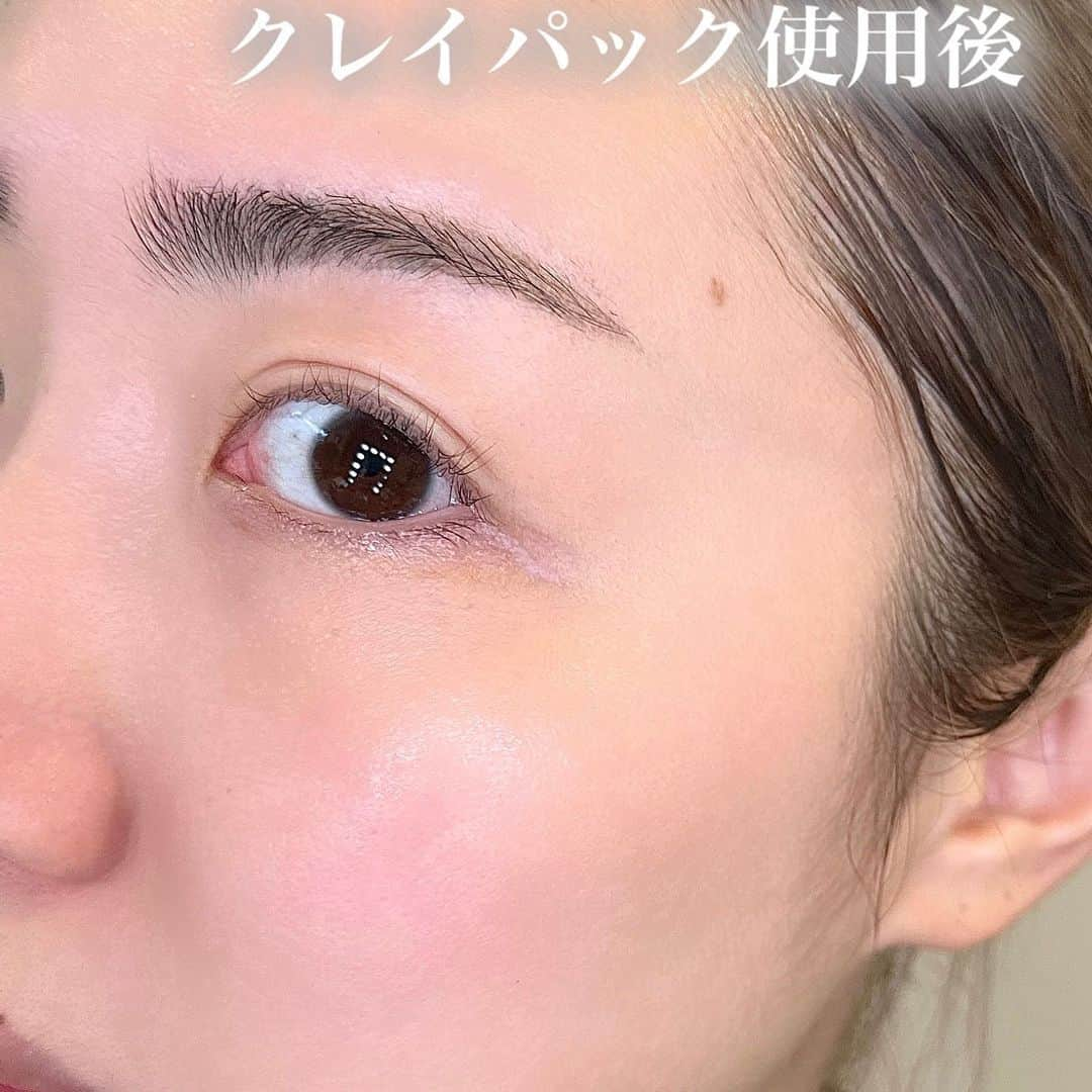 夏瀬ユウナさんのインスタグラム写真 - (夏瀬ユウナInstagram)「Tiktokで話題のこのクレイパック🧖🏻‍♀️⁡ 今回初めて使ってみました！⁡ ⁡ 3分おいて流すだけで⁡ 毛穴汚れももくすみ※もオフできちゃう🌱⁡ そして化粧水のなじみもよくなる！⁡ ※古い角質⁡ ⁡ まずパウチタイプっていうのが私的にお気に入りポイントで⁡ 扱いやすいし、最後までギューっと押し出せるのは嬉しい✨⁡ テクスチャーはとても肌に伸ばしやすくて、洗い落ちも早かったです❣️⁡ 洗い上がりもツッパリ感もなく心地よい使用感🙆‍♀️⁡ ⁡ 塗ったまま3分おくだけととても簡単だし⁡ 化粧水のなじみがよいつるんとした明るい肌に導いてくれるアイテム🫶⁡ お風呂の際にシャワーしながら使えたり、⁡ 洗顔料としても使えて⁡ 毎日気軽に毛穴のスペシャルケアとして取り入れられそう！⁡ ⁡ クレイパックには「2種のクレイ※1」×「炭※2」×「皮脂クリア成分」配合」で、⁡ 毛穴汚れとくすみ（古い角質）をしっかり落とせるんだって！⁡ ⁡ ※ 1ベントナイト、カオリン（吸着成分）⁡ ※ 2吸着成分⁡ ⁡ ⁡ 使用方法は投稿画像を見てみてね🌱⁡ ⁡ 【使用アイテム】⁡ ☑︎ビフェスタ クレイパック⁡ ⁡ ⁡ ⁡ あと今回もう一つ使ってみたのが泡タイプの洗顔🫧⁡ 毛穴よりも小さい約4,000万個※3のミクロの泡がワンプッシュで出てくる泡状洗顔料！⁡ 炭酸※4が含まれたキメ細やか濃密泡で、⁡ 毛穴の奥の汚れを落として、肌をこすらずやさしく洗えるよ！⁡ ⁡ こちらのアイテムは毛穴ケア効果と皮脂クリア効果にこだわられていて、泡洗顔シリーズ最高の洗浄力らしい👏⁡ さっぱりとした洗いあがりで、とてもすっきり感のある使用感でした❣️⁡ ⁡ ※3　1回あたりの使用量を目安に算出⁡ ※4　炭酸ガス（噴射剤）⁡ ⁡ ⁡ 動画を見てもらうとわかると思いますが⁡ 泡はほんともちもちでしっかりした泡で⁡ お顔にのせ広げるのも簡単♡⁡ ⁡ ⁡ 毛穴ケアアイテムをお探しの方、気になる方は⁡ 是非試してみてね✨⁡ ⁡ ⁡ 【使用アイテム】⁡ ☑︎ビフェスタ 泡洗顔 ディープクリア⁡ ⁡ ⁡ @bifesta_official_jp⁡ ⁡ #ビフェスタ #クレイパック #スキンケア #毛穴 #洗顔 #メイク落とし #洗顔料 #美容ヲタク #コスメ #基礎化粧品 #ベースメイク #メイク動画 #メイク #動画 #コスメレポ #コスメすきな人と繋がりたい #コスメ好きさんと繋がりたい #メイク好きさんと繋がりたい #セルフメイク #美容垢 #メイクプロセス #コスメレビュー #スキンケア動画 #メイク #新作コスメ #ドラストコスメ #プチプラ #プチプラコスメ #ビフェスタ_PR」4月20日 21時37分 - yuna_natsuse