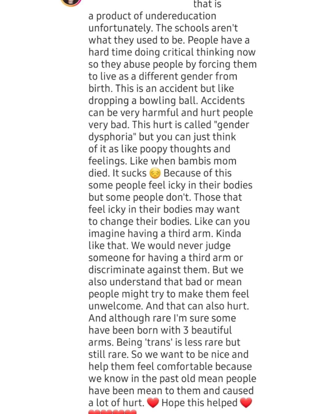 エマ・デュモンのインスタグラム：「About gender affirmation surgery 💗🤍💙」