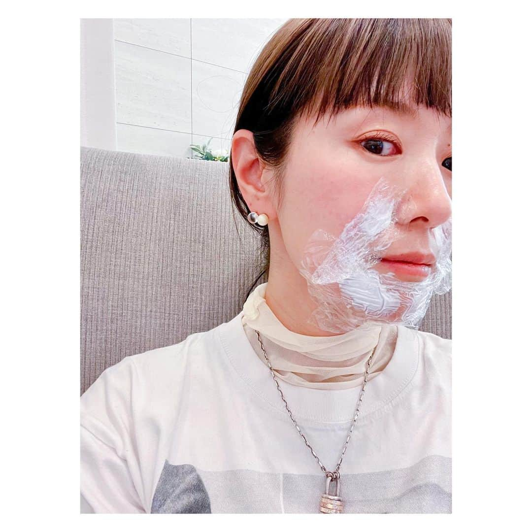 megumi matsuoさんのインスタグラム写真 - (megumi matsuoInstagram)「… 4月1日 4日目 韓国医療美容　初体験  やっぱり韓国来たからには何かしてみたいなとw 日本では高いけど 韓国ではお手頃なハイフをしてみよう と思って行ったら ショートの糸リフトになった件w  ま。そんな高くないし 糸は溶けてなくなるし 溶けるまでコラーゲンでるっていうし 気軽に提案してくるから 気楽にやってみよっかな と決めてしまったw  順番が回ってくるまで 麻酔を口元に塗ってラップして （写真のまんま） そのまま受付で待ってたw  施術室に入ったら カーテン越しにもう一台イスがあって そこに寝てた人は腰に何か打ってたw （見えるんかーーい）  私ぜんぜん怖くなかったんだけど かわいいワンちゃんのぬいぐるみを渡され これを抱いててくださいってw 初めての体験だから渡してくれたのかなw  糸リフトの長さはたぶん3〜４cmくらい 目を閉じててって言われたから刺すところは見てないけど　 口元よりも下の位置から 4本づつ鼻の方に向かって 扇状に刺してた 麻酔クリームだけだから やっぱり少し痛かったけど その刺激で何度かくしゃみが出そうになったw そして施術時間は10分もなかったw  傷？は 針が刺さった口元2箇所のみ 小さな赤い点２つ そこに爪くらいの大きさの再生テープはって終了  3日間くらいは つっぱりがあったり 軽めの筋肉痛みたいな痛さはあったけどw 内服とクリームがでてたから まったく気にならなかった  内出血もなにもなかったし 笑っても大丈夫だった  ただ唯一 歯磨きの時だけ 口を縦に開けた時だけ 微弱電流がはしる感じがあった  おー（糸が）いるいる♪ と思いながら歯を磨いたよねw  効果はというと サラは変わったって言ってくれる 私も少し変わったかな？？ってくらいw  ---------余談 クリニックが弘大だったんだけど クリニックに移動中 2号線と空港鉄道の連絡通路の 大型広告？電光掲示板？言い方古い？ の場所にキャーキャー騒いでる人だかりが  とりあえずムービー回したよね  ボイプラのフイ君って子だった （ストーリーにあげたら教えてくれた） 止まって撮ってたらあっちから近寄ってきて 避けないから私が避けてあげた 上から発言w  あとでムービー見せたらサラも知ってて なんなら前にここを通ったときも 金髪の男の子ともう1人いて その子たちもポイプラの子だったよ って言われた。 その金髪の子はリッキーっていうらしい 私も知ってたら1人で盛り上がれたはず 無知って損だわ  #ママ#ママライフ#アラフィフ#40代#韓国美容#韓国旅行#弘大入口#遭遇」4月21日 16時23分 - sara_mira_