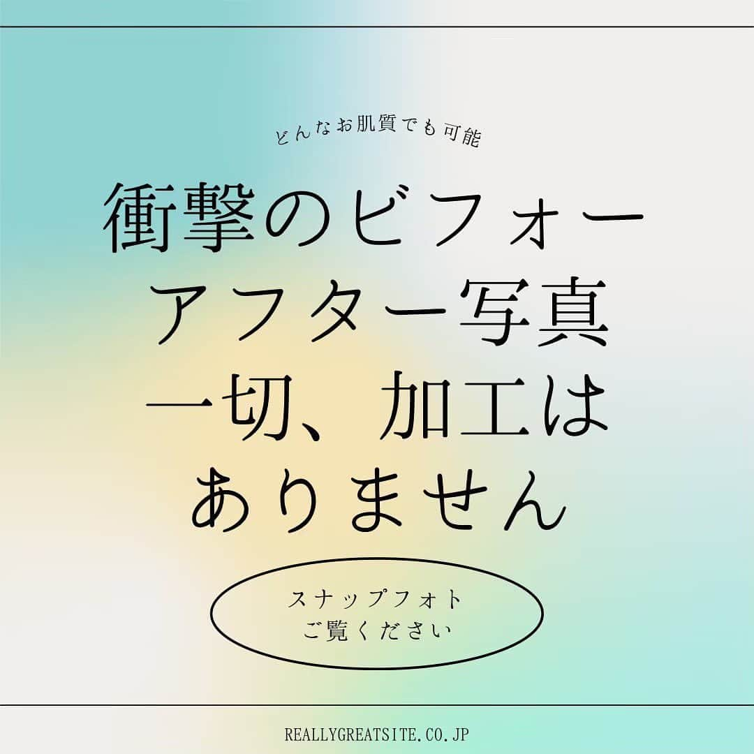 肌質改善専門サロン~Accueil~さんのインスタグラム写真 - (肌質改善専門サロン~Accueil~Instagram)「💌インスタのDM💌 ご希望日時・お名前・生年月日・お悩み内容をご明記の上ご連絡ください♡  🌿LINEの予約🌿 ご希望日時・お名前フルネームをご返信ください♡  📞お電話でのご予約📞 03-6912-5705にお願いします♡  ┅ ┅ ┅ ┅ ┅ ┅ ┅ ┅ ┅ ┅ ┅ ┅ ┅ ┅ ┅ ┅ ┅ ┅ ┅   肌トラブル専門店 Accueil(アクール)では 『機械を一切使わないオールハンド施術』 『50年の実績がある100%天然由来化粧品のみ使用』 他社にはない【イオン】の力を使い、【美肌蘇生法】を行います✨ 痛みや刺激、ダウンタイムも無いので安心してください😳🤝   ✔︎どんなケアをしても改善されない ✔︎繰り返す肌トラブルから抜け出せない ✔︎自分の素肌に自信が持てない ✔︎年中乾燥している ✔︎アトピーなど、敏感肌で悩んでいる ✔︎季節の変わり目、体調で化粧品が合わなくなってしまう  ...etc  どんな肌トラブルの方でも安心して受けていただく事ができるお肌にとても優しいエステです💆🏻‍♀️  Accueil(アクール)では、【肌・心・からだ 】の3ラインからアプローチすることで “肌質強化・早期改善”に繋がり、肌トラブルから卒業できます☺️🌸  どんなお肌でも必ず改善する方法があります！ 気になった方はコメント、DMお待ちしております🎵  ┅ ┅ ┅ ┅ ┅ ┅ ┅ ┅ ┅ ┅ ┅ ┅ ┅ ┅ ┅ ┅ ┅ ┅ ┅ #ニキビ#ニキビケア#ニキビ跡#ニキビ改善#ニキビ肌#ニキビ治療#背中ニキビ#ニキビ跡ケア#ニキビ肌改善#ニキビ跡改善#エステ#エステ#エステサロン#エステキャンペーン中#毛穴#敏感肌#乾燥肌#すっぴん#肌質改善サロン#肌質改善#美容#池袋#恵比寿#銀座#表参道#渋谷#新宿#新大久保#原宿#美肌#美容女子」4月23日 20時43分 - accueil_ikebukuro