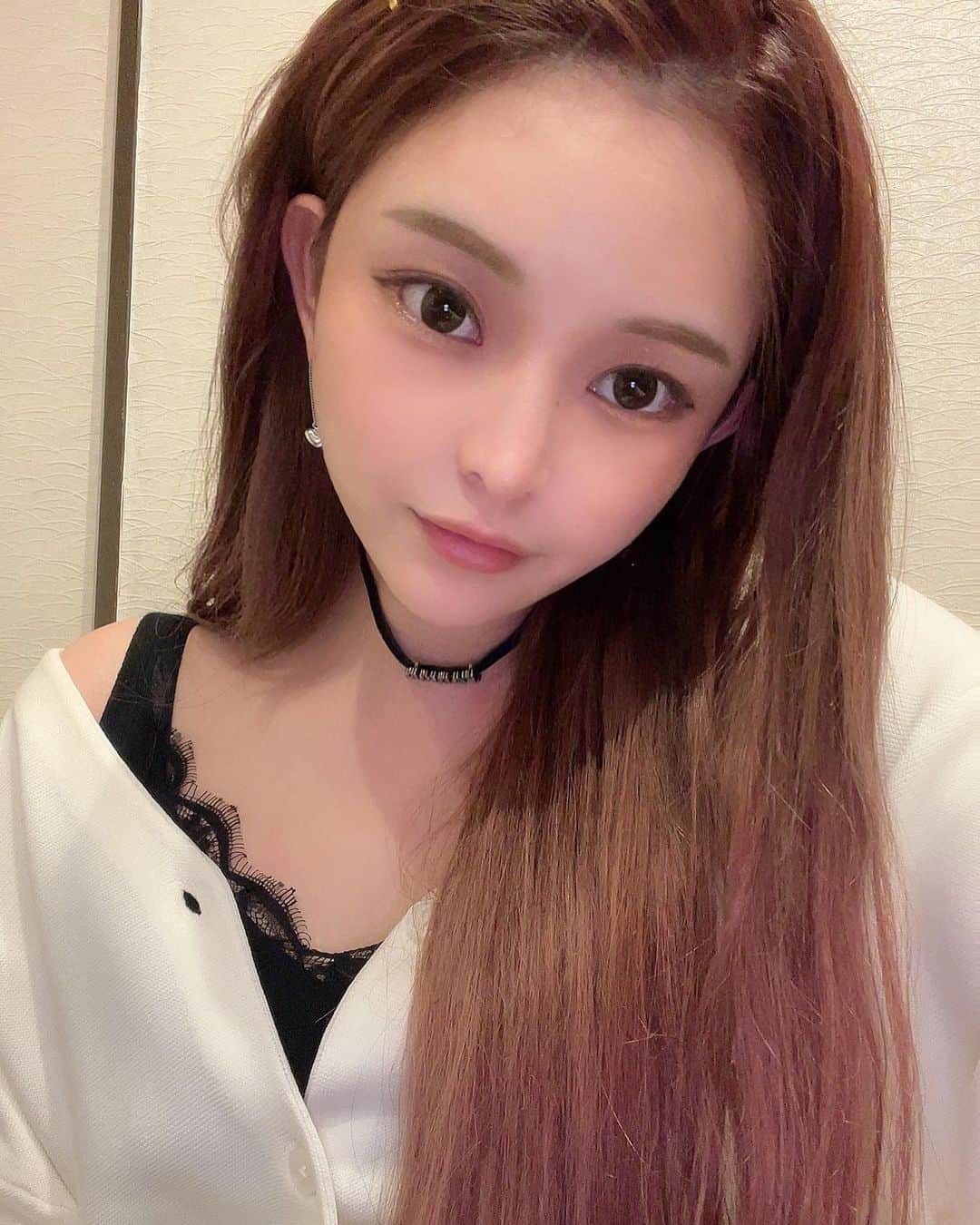 sayaのインスタグラム：「@aclinic_shinjuku で新宿院の柚崎先生 @aclinic_yuzaki のパーフェクトアイズ✨  経過報告👏✨ ダウンタイム1週間は覚悟してたけど２日目にはめちゃくちゃ自然で違和感がなかった😳👏 2週間たってからはナチュラルに目が大きくなって大満足🫶💕  #aclinic #aclinic銀座 #aclinic横浜 #aclinic新宿#aclinic名古屋#aclinic大阪 #aclinic福岡#aclinic池袋 #aクリニック #エークリニック #目尻切開 #目尻長め #目整形 #タレ目 #タレ目整形  #たれ目 #デカ目 #パーフェクトアイズ #グラマラスライン #グラマラスライン形成 #プチ整形 #整形 #美容整形  #美容 #美容外科 #美容クリニック#柚崎一輝」