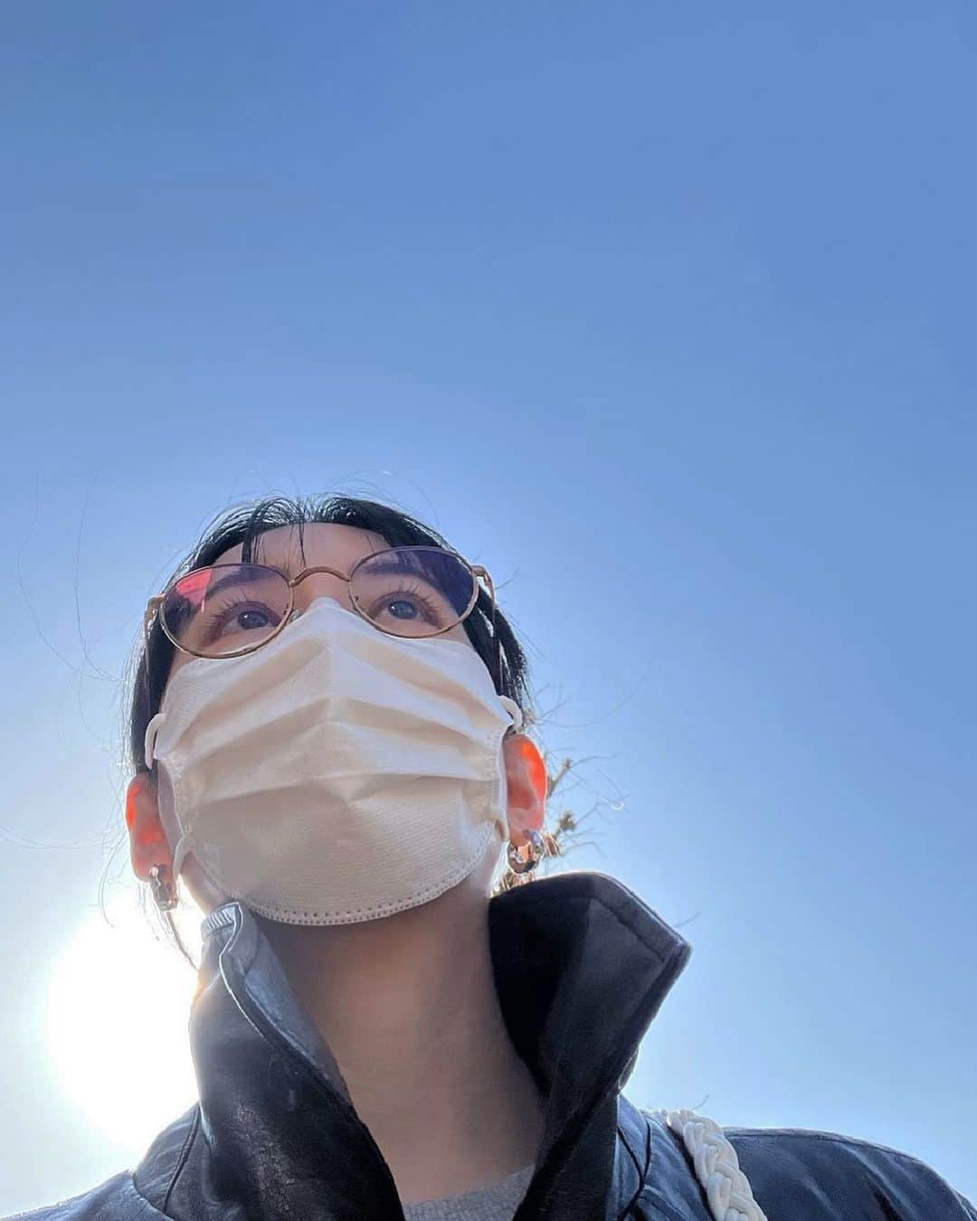 TOMOMIのインスタグラム：「やっと痒くなくなった」