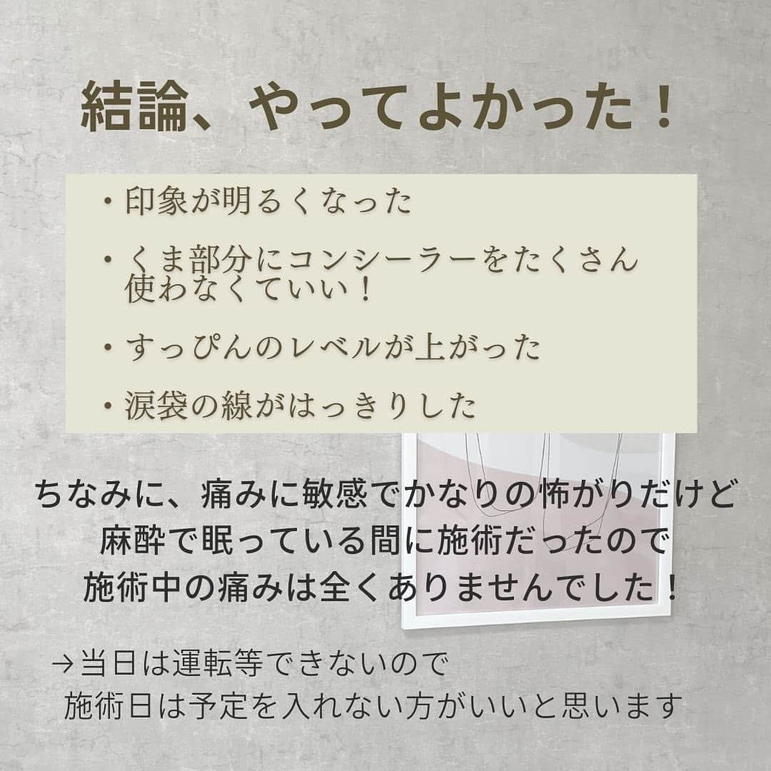 ときみつたかこさんのインスタグラム写真 - (ときみつたかこInstagram)「たくさんご質問をいただいていた、くま取りについてまとめました📌  当日は朝からビビりまくってたけど、麻酔で眠ってる間に終わってて なんともなく無事終わりました笑  写真よりやっぱり実物の方がビフォーアフターわかりやすいのですが、結論やってよかったです！  ・印象が明るくなった ・くま部分にコンシーラーをたくさん使わなくていい！ ・すっぴんのレベルが上がった ・涙袋の線がはっきりした  ただ、私みたいな皮膚が薄くて筋肉が透けて見えるくまタイプは 膨らみが多い方に比べるとビフォーアフターの振れ幅は少ないです！  その点も含めきちんと説明してもらってからしたので、結果かなり満足してます😊  くま取り気になってる方の参考になれば幸いです🙏  お願いしたクリニックは、プライベートで5年前くらいから通ってる　@sbcbeauty_official さんです✨  担当してくださったのは🫶@sbc_himeji1  @sbc_murakami   ーーーーーーーーーー Takako : 159cm / #骨格ウェーブ / #ブルベ夏 他の投稿を見る→【@takako_tokimitsu】 ーーーーーーーーーー  #くま取り #クマ取り #ダウンタイム #クマ取りダウンタイム #クマ取りレポ」4月28日 18時40分 - takako_tokimitsu