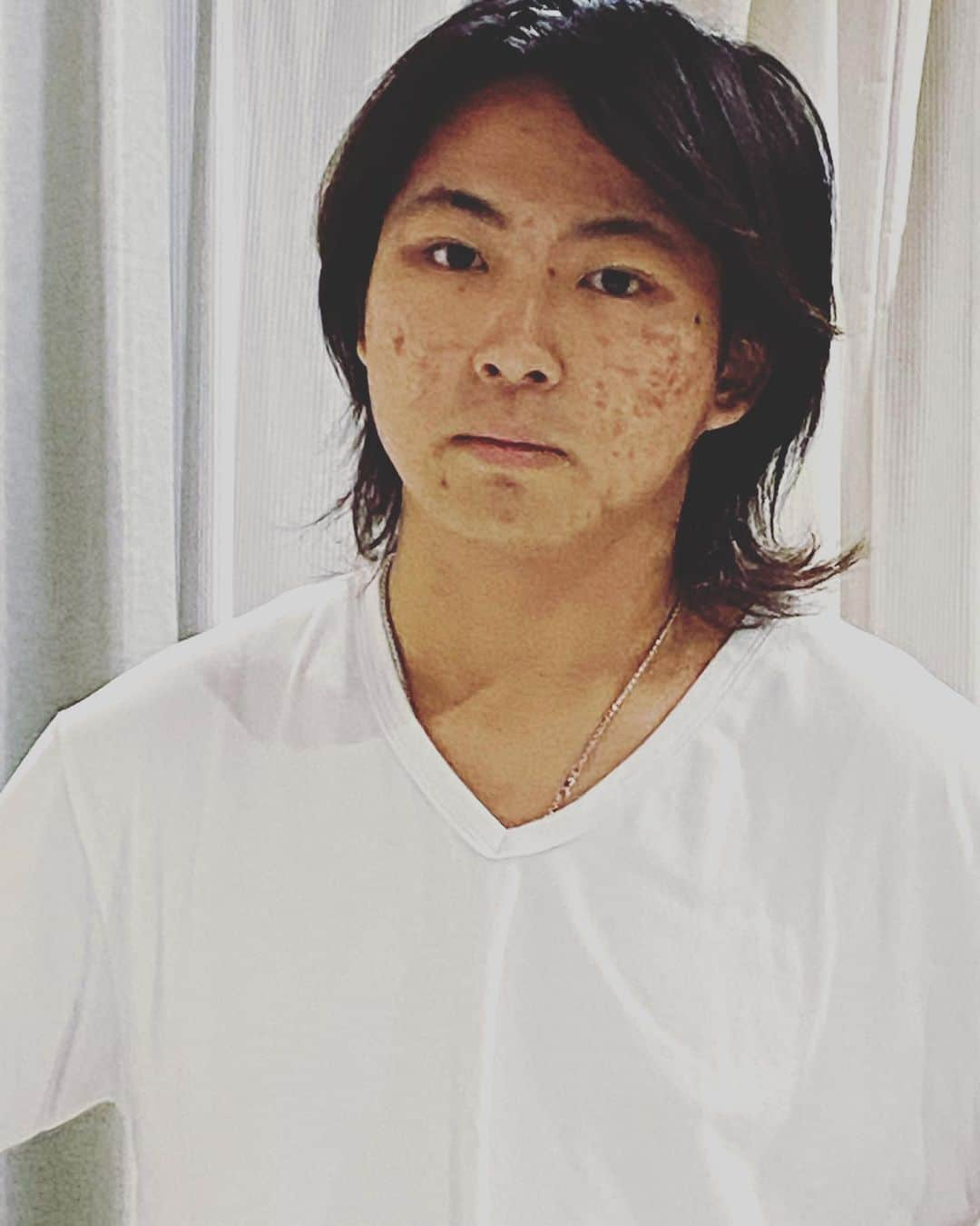 木下博勝さんのインスタグラム写真 - (木下博勝Instagram)「おはヨネスケ JJが帰って来ました。家の雰囲気が一気に明るくなりました。話が面白いので、僕の食いつきも、ついついウザくなってしまいます。（笑）  長野で携帯を道に落として、車に踏まれて壊れたようで、新しい機種を買っていました。保証に入って無かったのかな。 でも、iPhoneはPCから、元の携帯の設定通りに新しい携帯にダウンロード？出来るようです。 今日は、ジャガーさんは後楽園ホールでタイトル戦です。ケガなく活躍して欲しいです。 JJは今日もデート？で、インスタライブに間に合わないかも、と言われました。そりゃデート優先するよね。（笑） さいたま新都心ジャガークリニックは連休中も、休みなく診療していますので、よろしくお願いします。  さいたま新都心ジャガークリニックで一緒に、地域の為、国の為、自分の為に、働いて頂ける、看護師、医療事務の方を急募です。 当院の理念に賛同して頂ける小児科のドクターも募集中です。 宜しくお願い申し上げます。  クリニックのHPをご覧頂くか、saitamajaguar@gmail.com までご連絡お願い申し上げます。  #JJ #さいたま新都心ジャガークリニック #さいたま新都心　#北与野　 #さいたまスーパーアリーナ #さいたま市　#中央区　#与野　#さいたま県 #小児科　#内科　#外科 #ジャガーファミリー #ジャガー横田 #7.18 #後楽園ホール」4月29日 9時28分 - hirokatsu_kinoshita