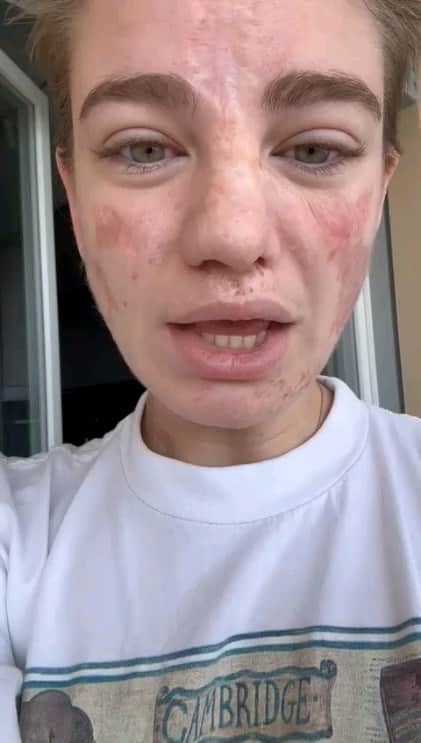 ベアトリーチェ・ヴィオのインスタグラム：「🚨 ATTENZIONE 🚨  L'altro ieri sera mi è stata rubata la borsa in un ristorante di Roma 🥺 Non mi importa granché di tutto quello che è stato rubato. Dentro, però, avevo il mio computer con i file della tesi di laurea che devo consegnare a giorni.  📩 A te, che ora hai il computer, ti prego di farmelo riavere o almeno di inviarmi in forma anonima i file con la mia tesi, alla mail 𝗶𝗻𝗳𝗼@𝗮𝗿𝘁𝟰𝘀𝗽𝗼𝗿𝘁.𝗼𝗿𝗴.  Trovi tutto sul desktop del computer nella 𝙘𝙖𝙧𝙩𝙚𝙡𝙡𝙖 "𝙅𝘾𝙐"  Nonostante tutto, te ne sarei immensamente grata 🙏🏻」