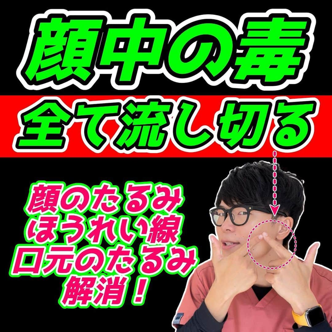 ゆう先生さんのインスタグラム写真 - (ゆう先生Instagram)「【老廃物を流して-10歳若返る】10秒押すだけ！顔中の毒素を流してほうれい線、顔のたるみ、マリオネットライン、ゴルゴラインを解消するエクササイズ！  体操をやってくれたらぜひ🔥コメントで教えて下さいね😆  共感、応援してくれる人はぜひ いいね👍 フォロー✨ 保存😎 お願いします😊✨ いいね👍保存が1番の励みになります！  ストーリーでは僕が日々やっているエクササイズの紹介やリール動画の解説、視聴者さんの質問回答&相談をしていますので必ず覗いてみてくださいね🔥  本質的に健康的になりたい人は保存マークがオススメです😆  ーーーーーーーーーーーーーーー 🔥情熱の治療家ゆう先生のプロフィール🔥 7年間の病院勤務で痛みや老化、美容の根本原因を解消せずに  『その場しのぎ』  のリハビリや処方をする現代医学に嫌気がさし、京都市伏見区で整体院悠を独立開業する。  スタッフのみお先生 @kyoto_seitai_yu   とともに京都のみならず全国からのお身体の悩みを改善し続けている。 ーーーーーーーーーーーーーーー  気になることがあればコメントに気軽にご質問くださいね😊 言いにくいことでしたら、直接DM頂いても大丈夫です👌  毎月第２土曜日22:00〜でInstagramで質問相談ライブ配信をしています！ぜひフォローして来てください😊  #ほうれい線 #顔のたるみ #口元のたるみ #マリオネットライン #ブルドック顔 #美容整体 #ゆう先生の美容整体塾」4月30日 17時30分 - seitai_yu_kyoto