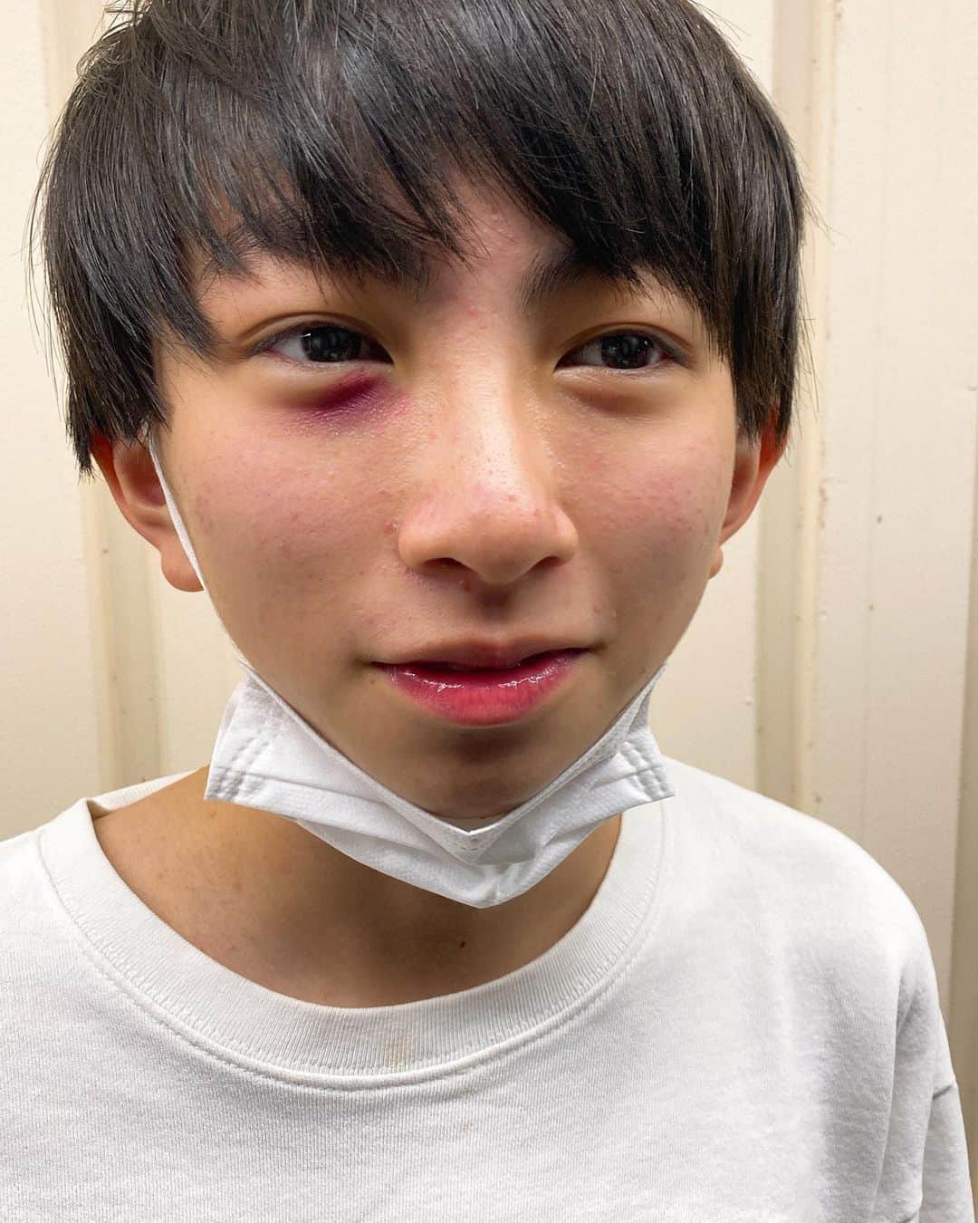 太陽チャンネルのインスタグラム：「みんなごめん… 心配かけて…実はこれ…  化粧品のテスター塗って 店から出てきた太陽くんでした😂 まさかこんな心配コメントくるとは思わなくて ほんとごめんなさい全力で謝罪🙇‍♀️🙇‍♀️🙇‍♀️  #中学生 #厨二病 #太陽チャンネル」