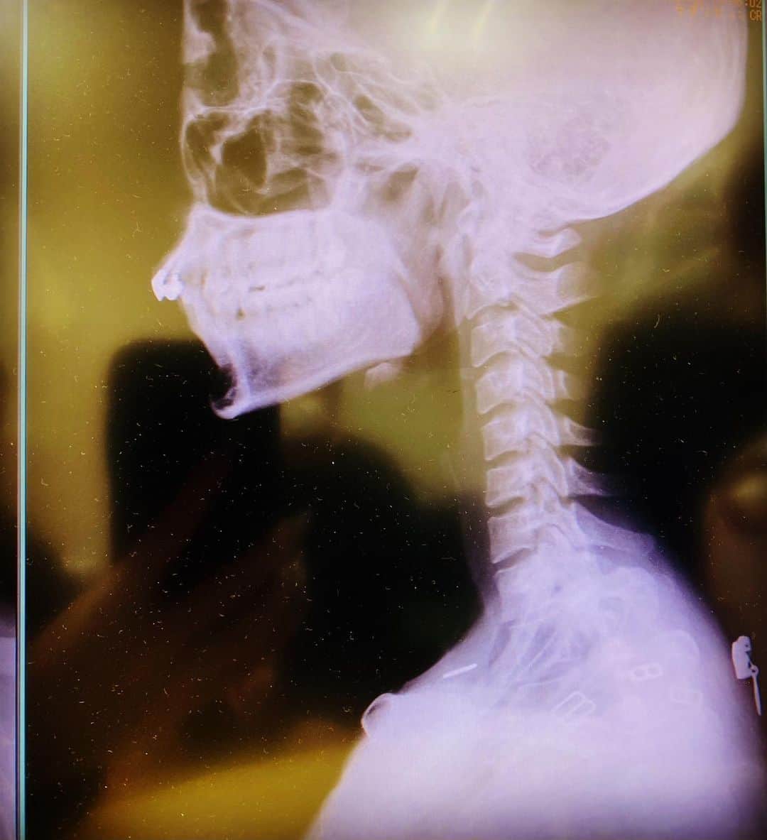 葵ローズのインスタグラム：「straight neck」