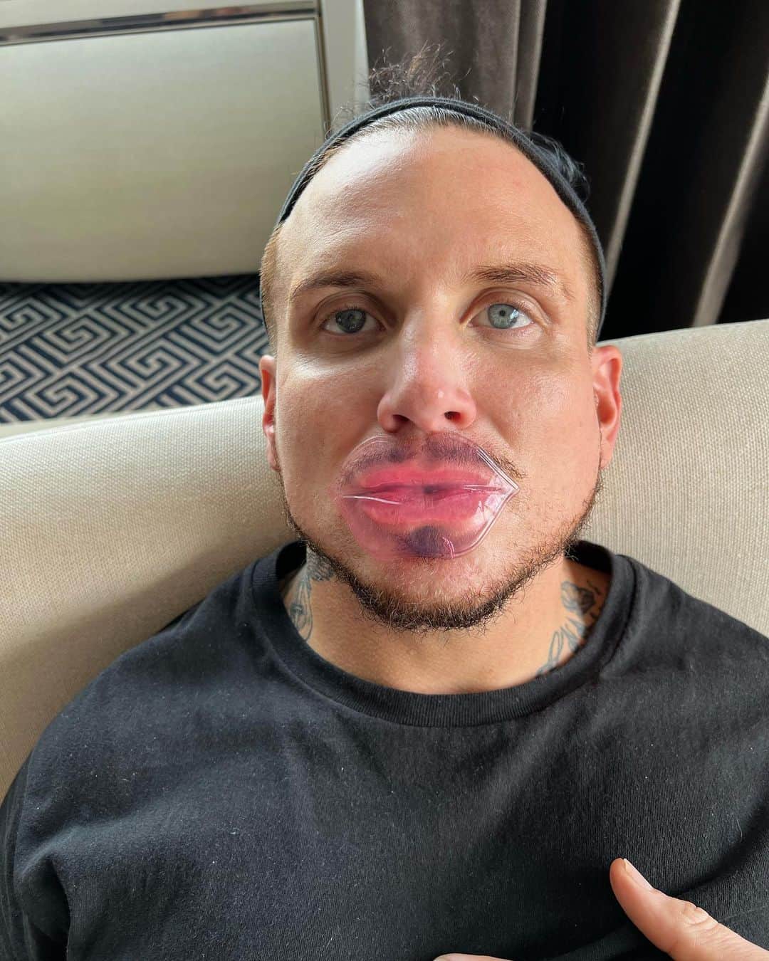 マーク・ジェイコブスさんのインスタグラム写真 - (マーク・ジェイコブスInstagram)「husband with lip mask.  I love him.  @chardefrancesco   #metmouth #gratefulnothateful」5月2日 1時37分 - themarcjacobs