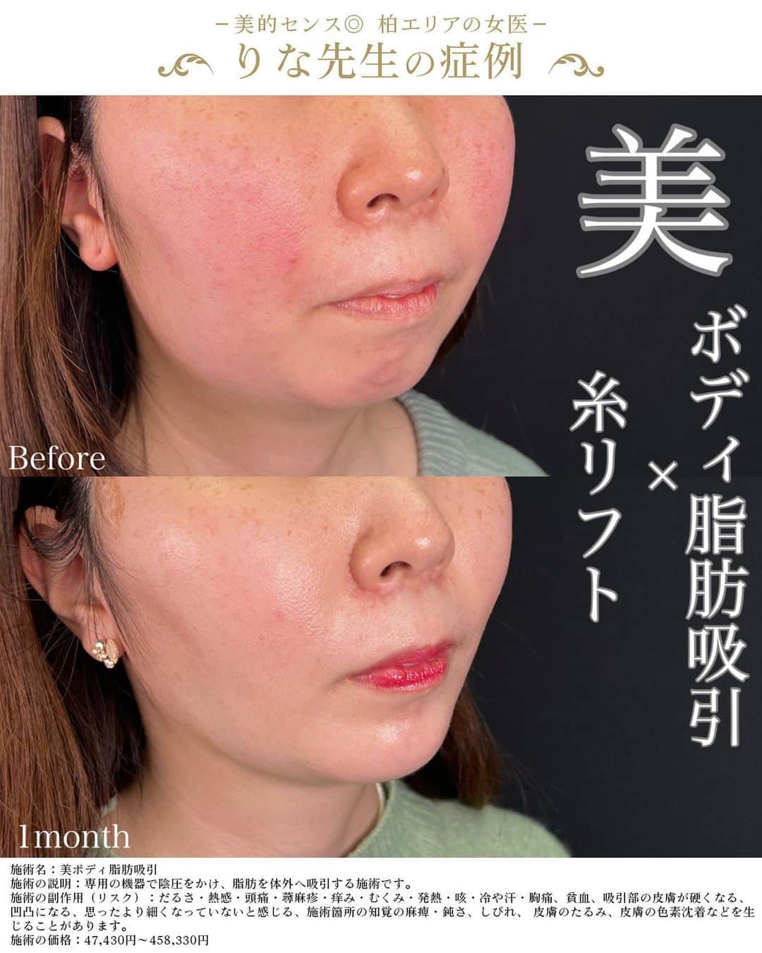 湘南美容外科 柏院のインスタグラム