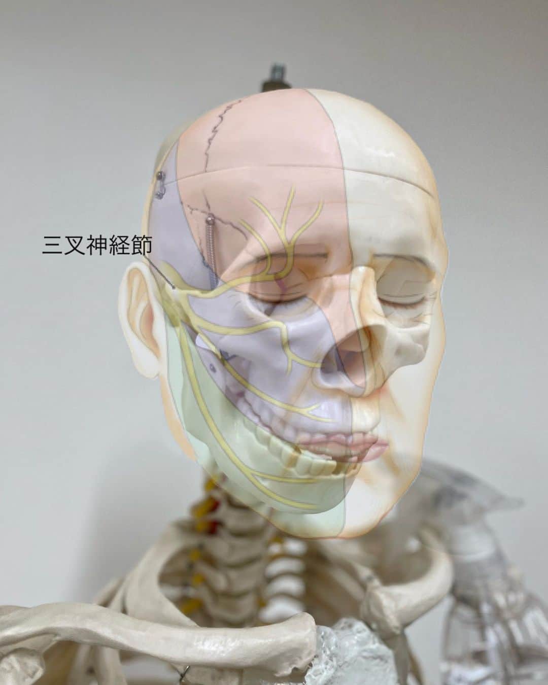 chinatsu614さんのインスタグラム写真 - (chinatsu614Instagram)「Trigeminal nerve  treatment. ・ ・ ・  先日、祐天寺にある @seikotsu.hit しょうわ整骨院で 初めてTNブレイン療法を体験してきたの☺︎‼︎  「TNブレイン」療法とは✎✐ 顔に振動を入れることで脳に通っている三叉神経に刺激を与えて脳が引き起こすエラーにアプローチして、エラーを改善する事で身体が「動かせる」と判断し、可動域が広がったり身体の歪みが矯正できたりする施術。  振動療法なので電気治療のようなピリピリした痛みは全くないし 振動の痛みもなかったよ。  ただ初めてだったので 顔が潰れるんじゃないかっていう恐怖はあったけど笑 音アリにしたので動画見てね笑 結構の爆音‼︎笑  振動刺激による「脳のエラー」の解除によって 原因がわからなかった痛みや不調の改善を図ることもできるんだって。  脳のエラーを解除してからの矯正なので効果が顕著に現れて、私は腕と股関節の可動域が広がったのと、身体の歪みが改善されて左右のバランスが整った‼︎  運動のパフォーマンスも上がると聞いてジムも行ったよ☺︎  そして、なんと整骨院にエステも併設されていて整えてもらった直後の良い状態をキープしたまま至福の時間も♥︎  整骨院で脳、神経、骨、筋肉を整えてもらい全身の反応を向上した上で工ステ施術を受ける事で、相乗効果が増し増しなんだって‼︎☺︎‼︎  クレイパックが肌に合っていたのか肌艶UP♩気になっていた毛穴もキレイになっていて感動。気付いたら爆睡してたので写真が無い笑  TNブレイン療法がある整骨院はとっても少ないので 探している方は是非‼︎   整骨院からのエステも気持ち良くってハマりそうーーー♥︎  ・ ・ ・ PR @seikotsu.hit #しょうわ整骨院  #祐天寺整骨院 #祐天寺エステ  #リンパケア #目黒整体  #目黒エステ #祐天寺整体」5月2日 22時32分 - chinatsu614
