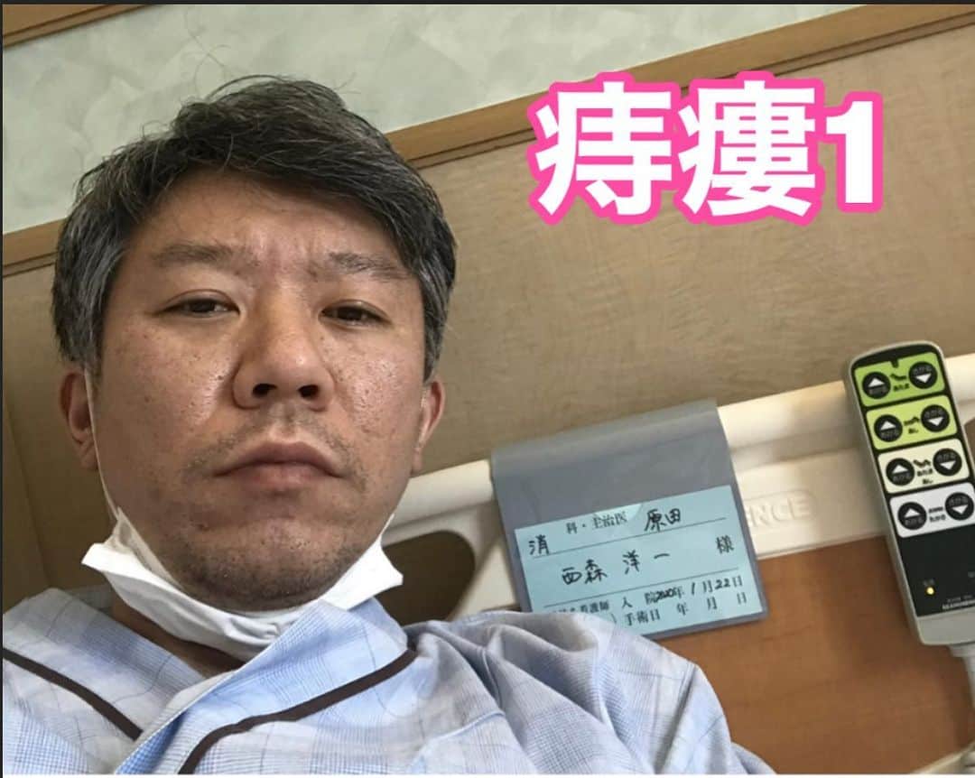 のインスタグラム：「2017.6.19「入院一日目」前半。六年前の日記です。 日記朗読ライブ抜粋。  さっきから、入院しています。　 今､ベッドの上で、この日記を書いている。 、 たまに試みる「リアルタイム日記」というやつです。リアルタイムで起こった事を書き記していきます。 、 「痔瘻」(じろう)  という痔業界でも世界ランキング常に1位の、ややこしい痔になってしまった。 、 だから、手術のため入院しています。 、 『説明しよう！！』 痔瘻とは……肛門を入って数センチの「直腸と大腸の境目」あたりから､、外のお尻や､肛門横などへ、勝手に通り道の「管」を作り、 その管が化膿するという、世にも汚く意味不明な、痔なのだ！ 、 肛門があるというのに、何故また新たに管を作る必要があるのだ？  意味がわからん。 セルフサービスで、細〜い肛門を作って何になるのだ！ 、 身体を曲げて肛門に口がつくなら、メガホンみたいにして、絶叫してやりたい。 、 肛門から唇は5ミリぐらい離すわ！ べちゃっとつけへんわ！ 、 、 そのセルフサービス管を、取り除くための手術は、明日の朝だ。　 、 今、昼の、12時48分。 、 朝9時半に梅田の、この病院へ到着。 手続きして、病院内の諸々の説明を受けた。 、 手術は明日。 、 もう既に、1時間48分前から､する事がない。　しかし、外出も駄目ときた。 、 で、1晩寝て……明日の朝９時から手術。 それまで……ただ……ひたすら待機。 、 、 ん〜〜〜〜、、呼ぶの早ないっ？！！ 、 今日の晩からで良くない？　 、 今日の夕食時までは、何を食べても飲んでもいいんですって……じゃあやっぱり、晩からの入院で良くない？ 、 呼ぶの早ない？  、 漫才出番なんて、10分前に楽屋にスタッフが呼びに来るよ。 移動含めたら、七分前ぐらいに袖に着くよ。  ほんで直ぐ舞台出て漫才やで！ 、 に……比べて早ない？ 、 後半に続く…………。  、 おやすみなさい。」