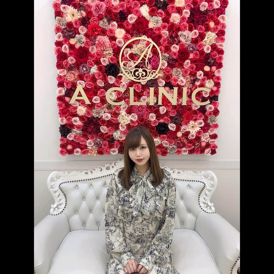 のインスタグラム：「A CLINIC新宿院(@aclinic_shinjuku)の 戸田貴之先生(@aclinic_toda )に Aスレッド(糸リフト)施術してもらったよ‼︎ . . 前回の糸リフトから時間経ってまたたるみやボコつきが気になって来たので今回受けたよ🪡 . 2枚目の写真で分かると思うけど今回もAスレッドでフェイスラインしっかり引き上がってしゅっとしたよ🥳 キツめに上げてもらってるから数日後が楽しみ♪ . . 戸田先生はインスタで見かけた事あったんだけど 実際に見ても山Pに似てた😳‼︎ 院内も綺麗でスタッフさん達も優しかったよ🙆‍♀️ . . 次は脂肪吸引も気になるなぁ🤔✨ . . . . . . #aスレッド #糸リフト #aclinic #aclinic銀座 #aclinic横浜 #aclinic新宿 #aclinic名古屋 #aclinic大阪 #aclinic福岡 #aclinic池袋 #acllinic仙台 #aクリニック #エークリニック#小顔 #リフトアップ #スレッドリフト #小顔整形 #たるみ改善 #美容外科 #美容皮膚科 #美容クリニック　#戸田貴之」