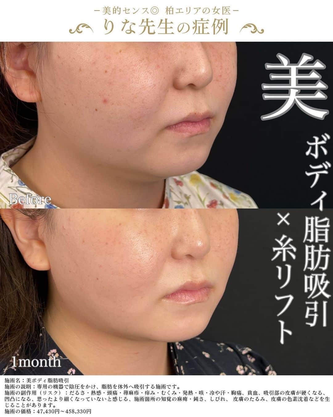 湘南美容外科 柏院のインスタグラム