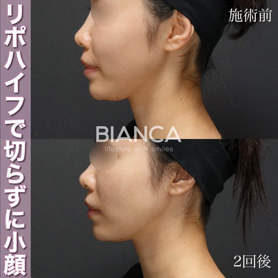 辻沢由有（BIANCA CLNIC 表参道院 院長）のインスタグラム