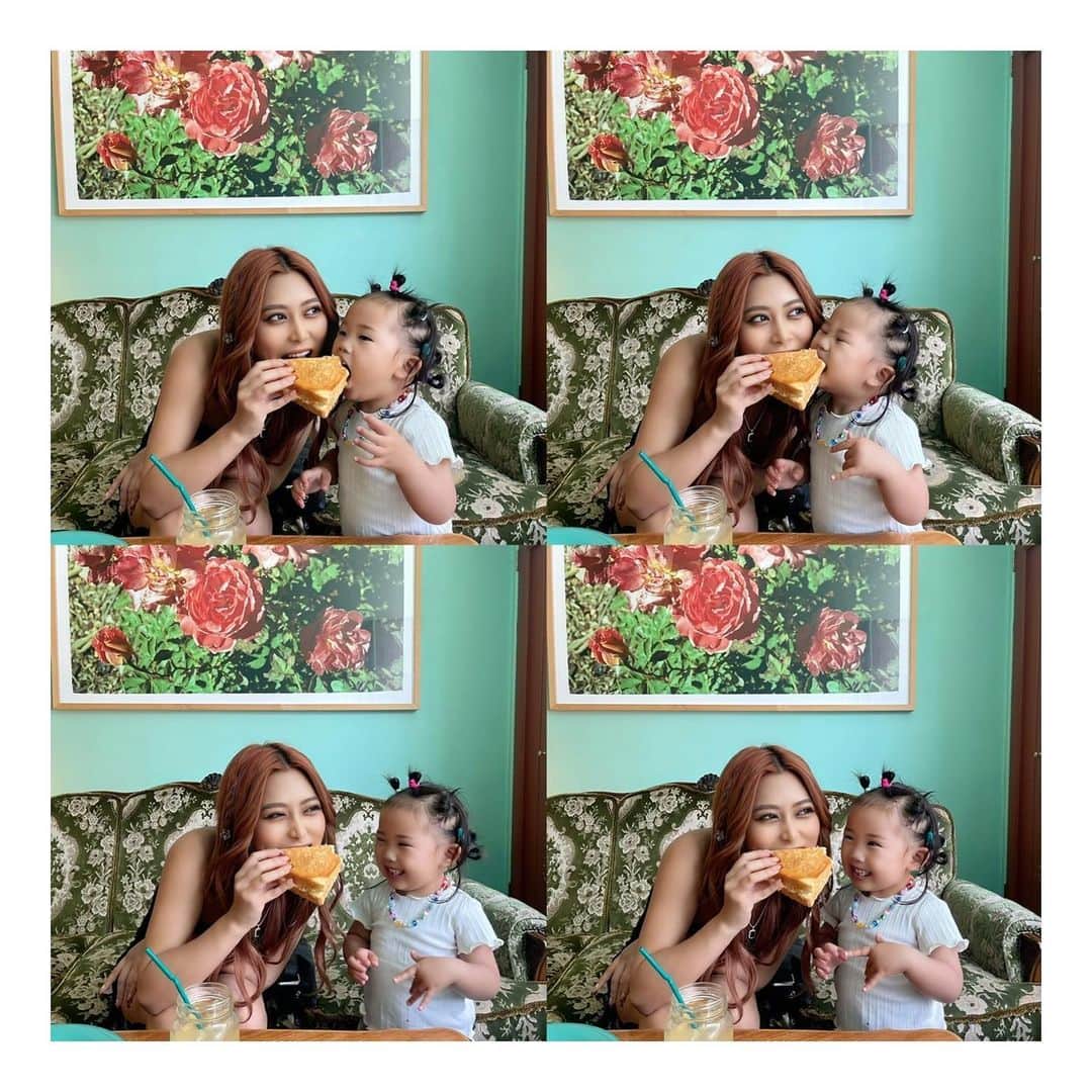 松葉愛海のインスタグラム：「ストーリーで好評だった4コマ🥪👧🏽  ・ ・  @tclinic_shinjuku でおでこにヒアルロン酸注入してから3週間経ったんだけど  お顔が前より盛れるようになったし 横から見ても凹んでた部分がちゃんと丸くなってて  もっと横顔とかが綺麗に見えるようになった🥺✨  ダウンタイムとかも無かったからよかった✨  @tclinic_sagara 先生いつも有難う御座います👨🏼‍⚕️」