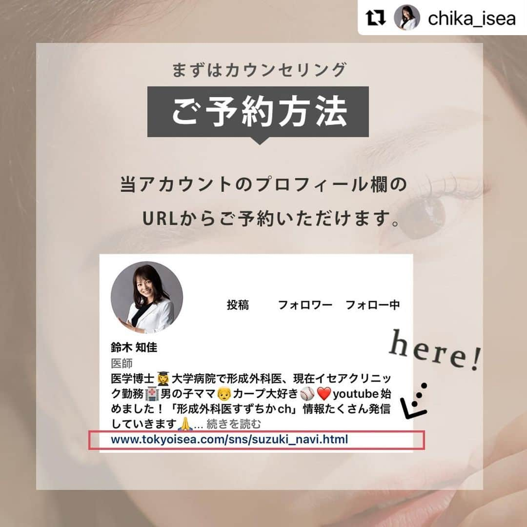 東京イセアクリニックさんのインスタグラム写真 - (東京イセアクリニックInstagram)「#下眼瞼脱脂術  #目の下のたるみ治療（脂肪）  ▼執刀医 医学博士・形成外科専門医 Dr. 鈴木知佳  @chika_isea   ▼詳細  Before・・・術前 After ・・・1か月後  【施術の詳細】 🕐手術時間 ・・・約1時間 👁ダウンタイム・・・約1週間 📆完成まで ・・・約3か月 🏥術後の通院　・・・2回（1ヶ月検診、3ヶ月検診）  【下眼瞼脱脂術とは？】 目の結膜部分（アッカンベーをしたときに出る赤い粘膜部分）から、目の下の膨らみの原因となる脂肪を取り除く施術です。  【こんな方におすすめ！】 ✔️目の下のたるみを改善したい方 ✔️目の下の膨らみが気になる方 ✔️目の下のクマが気になる方  【保証について】 ・再手術無料保証 効果に満足いただけなかった場合、6ヶ月間無料で再手術を受けていただける保証制度です。  【リスクについて】 凹み、くぼみ、感染、左右差が生じる、小ジワや皮膚のたるみが目立つ可能性  ---------------------------  ▫️術名 下眼瞼脱脂術 ー目の下のたるみ取り（脂肪）  ▪️料金 両目　295,000円(税込)  (麻酔費・痛み止め費・再施術費込み)  ⏩目の下のたるみ治療だけの 症例写真やお役立ちコンテンツを毎日更新！ 『　@menoshita＿isea　』 ご質問がある方はお気軽にDMして下さい🙋‍♂️  #目の下のたるみ #目の下のクマ #目の下のたるみ取り #目の下のたるみ治療 #目の下クマ治療 #目の下のクマたるみ治療 #下眼瞼脱脂術 #イセアの目の下のたるみ治療 #経結膜法 #下眼瞼除皺術 #ハムラ法 #美容外科 #美容外科医 #美容クリニック #美容整形 #目の下 #目の下の改善 #目の下のクマ改善 #目の下のふくらみ取り #目の下のふくらみ #目の下の脂肪 #目の下整形 #東京イセアクリニック #イセア #ISEACLINIC #吉種克之 #鈴木知佳」5月30日 11時58分 - iseaclinic