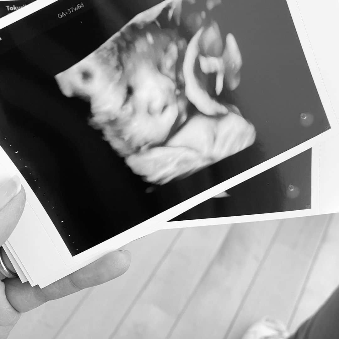 片桐ゆたかのインスタグラム：「38w🖤  先週から子宮口1センチ開いてて 先生には来週辺りかなと👨🏻‍⚕️  寝顔が兄妹にそっくりだなあ👶🏻  上の子2人は自然分娩 今回里帰りをしない&最後の出産(←ほんとに？と言われる)笑 はじめての無痛分娩！ 本当に痛くないと聞いてるため楽しみすぎる🎵  出産間近になってきたからか 先週から娘も体調を崩して なんなら私も今日からダウン😅  出産まで何が起こるかわからない  とにかく母子共に元気を出そう！！！  #3人目#38週#妊娠中#片桐ゆたか #maternity#yutakakatagiri#bigboy」