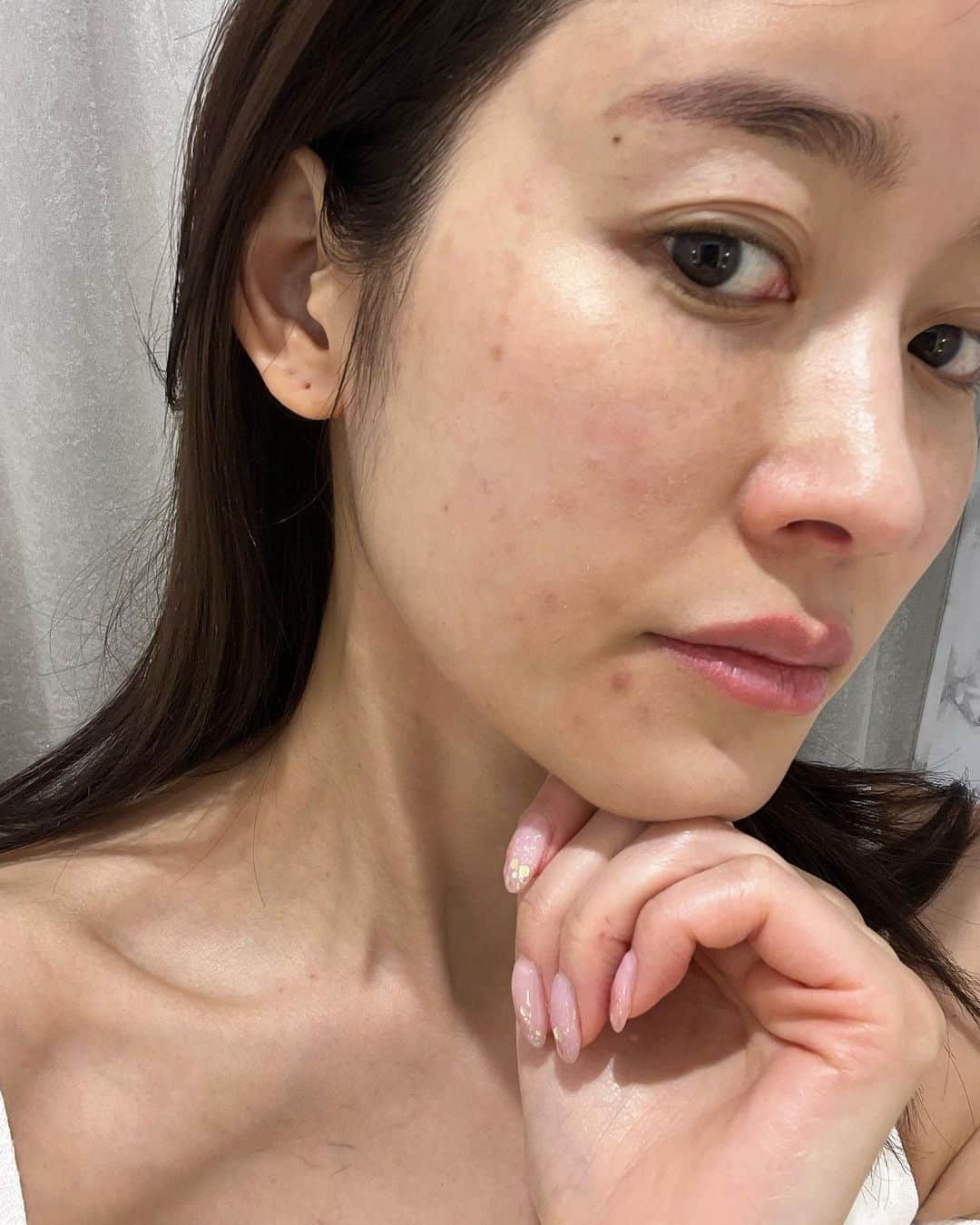 川口優菜さんのインスタグラム写真 - (川口優菜Instagram)「. 美容に詳しくなるって、 沢山失敗もするって事。  私のお肌の失敗話😂😂 最後の写真みてみて〜  美容が好き過ぎて、 沢山失敗もしてるんだー🤗🤗  なんでも聞いて〜😂 経験しないと本当の答えがわからないからね！  失敗は成功の始まりよ！笑  Look at my last photo, my skin is in disaster coz I always try way too many ways to "how to stay pretty'' 😂😂　  disaster🟰災害www #YUNAŚCHOICE #美容オタク #美容好きな人と繋がりたい  #美容好き過ぎて頭おかしい #失敗しまくり笑」5月30日 23時00分 - yuna.kawaguchi