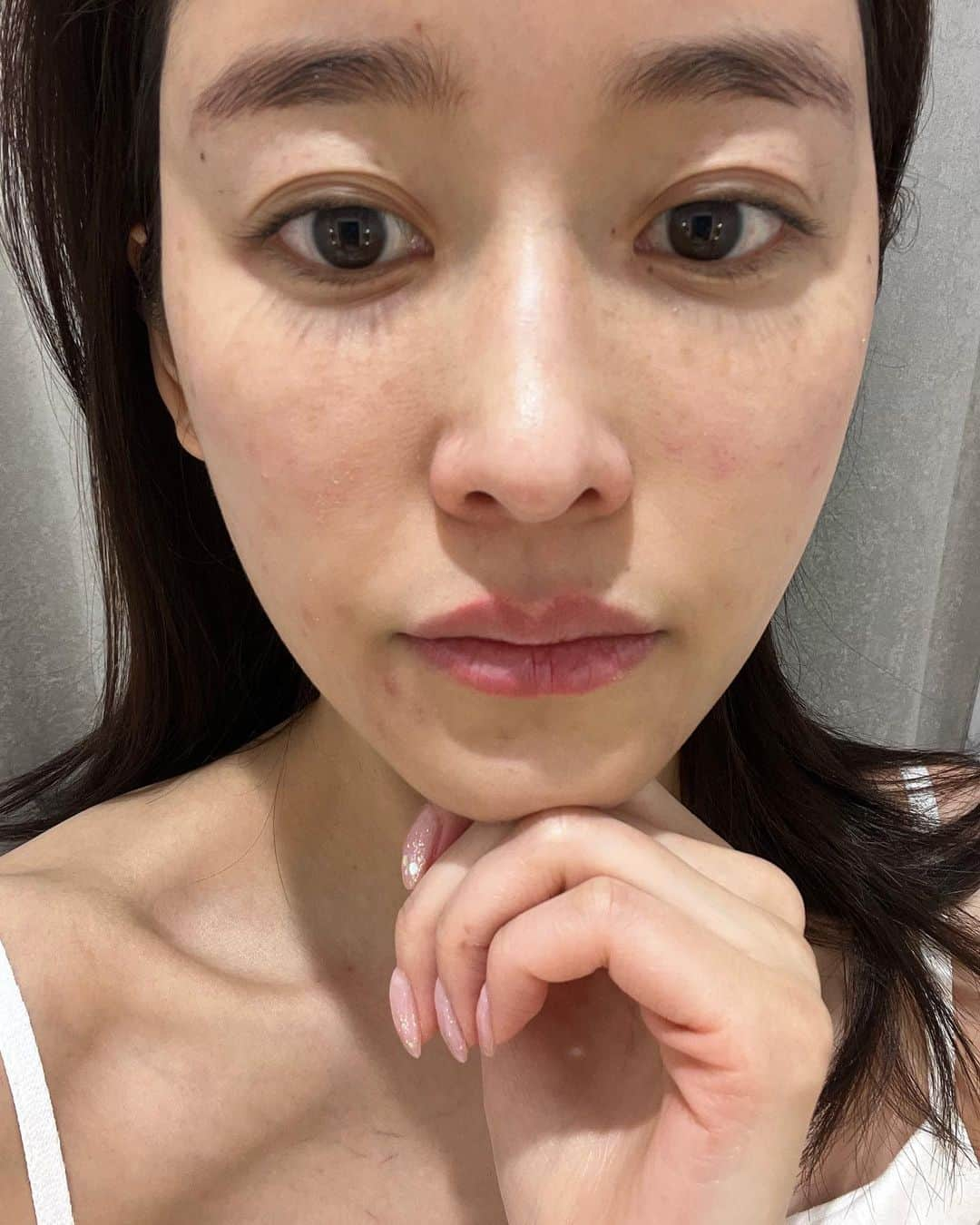 川口優菜さんのインスタグラム写真 - (川口優菜Instagram)「. 美容に詳しくなるって、 沢山失敗もするって事。  私のお肌の失敗話😂😂 最後の写真みてみて〜  美容が好き過ぎて、 沢山失敗もしてるんだー🤗🤗  なんでも聞いて〜😂 経験しないと本当の答えがわからないからね！  失敗は成功の始まりよ！笑  Look at my last photo, my skin is in disaster coz I always try way too many ways to "how to stay pretty'' 😂😂　  disaster🟰災害www #YUNAŚCHOICE #美容オタク #美容好きな人と繋がりたい  #美容好き過ぎて頭おかしい #失敗しまくり笑」5月30日 23時00分 - yuna.kawaguchi