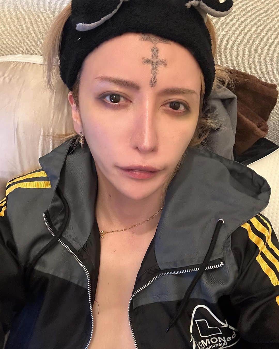 MiA のインスタグラム：「目が腫れている⚜️」