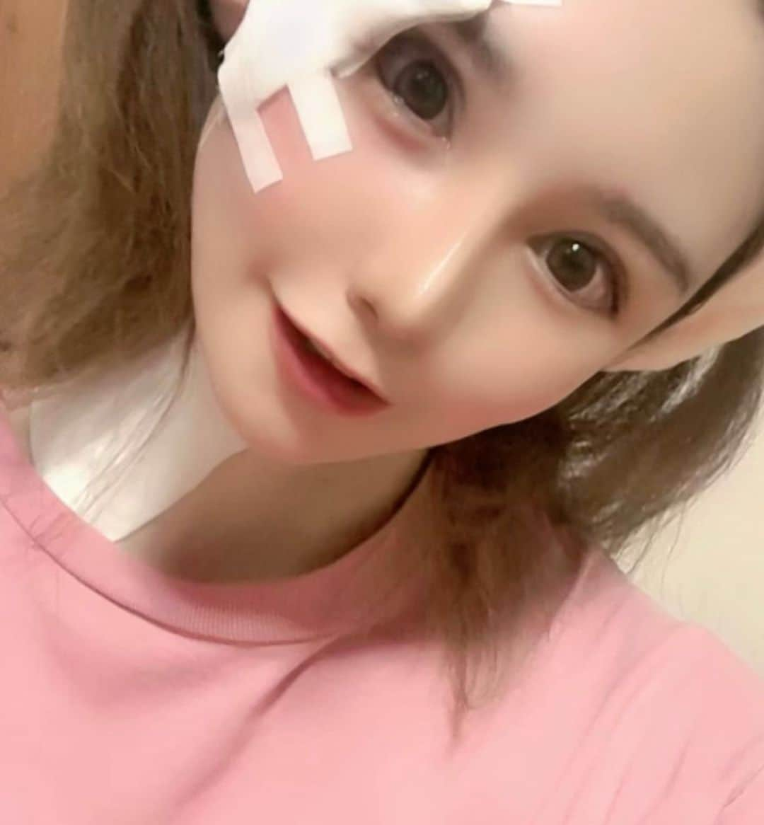 まさき沙耶さんのインスタグラム写真 - (まさき沙耶Instagram)「私過眠する日と眠れない日極端すぎて🫨🫨  2年前の写真と動画をiPhoneがおすすめしてきたので載せますw 最後は最近のボロボロの私で🩵  今髪の毛まだボブにしちゃおうか迷ってる😮‍💨🩷そっちのがいいって身内に言われて笑 単純なので笑  最近はがんばってのばしてたんだけど、、 わたしセミロングが1番似合わなくて🐳  美容師さんはせっかくここまで伸ばしたんだしって、 エクステでロング推しなんだけど、夏場のエクステって乾かすの地獄だよね🙄 #me #follow_me   この頃ソイジョイしか食べてなくて1番痩せてたと思うけど髪もパサパサだったな😮‍💨 いまは逆にまんまるすぎてどういうこと🟡⚪️🟠 傷の腫れだと言い聞かせたい。笑」6月2日 3時04分 - saya_masaki