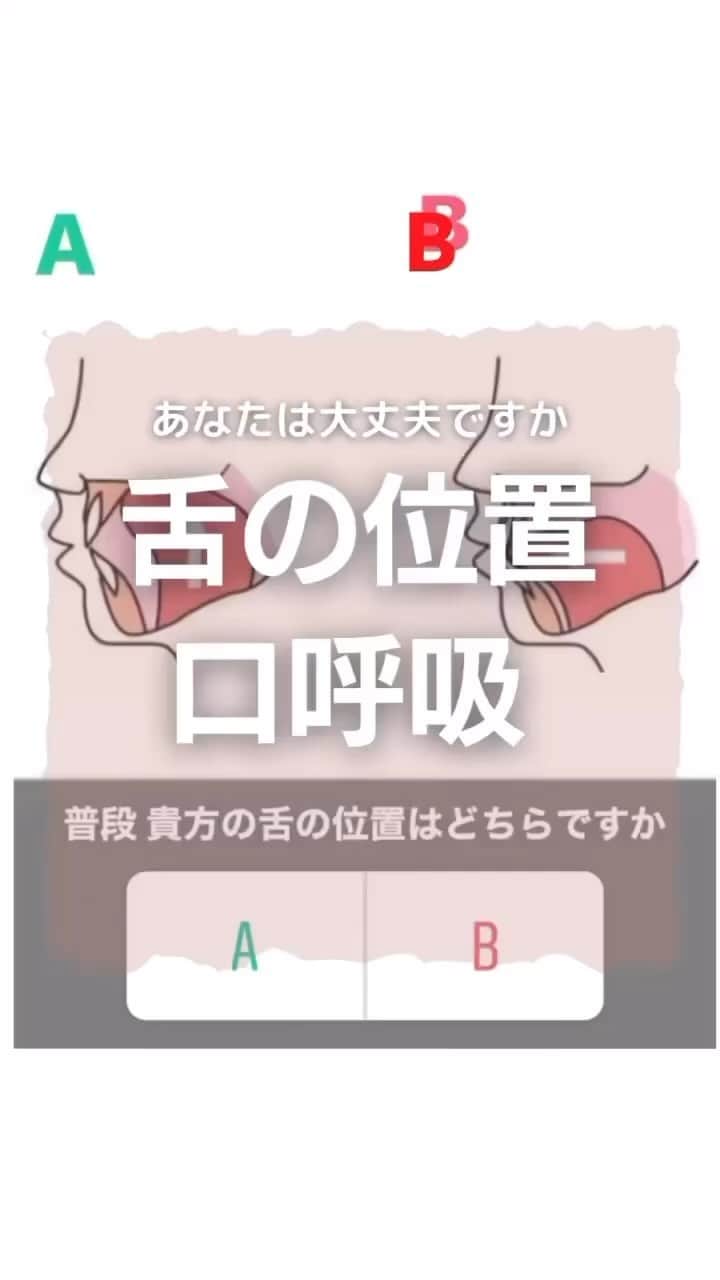 のインスタグラム：「#意外に知られていない口呼吸の弊害と鼻呼吸の重要性について  鼻の呼吸では、空気の通り道が狭く、 ゆっくり吸気されるため、取り入れられる空気は温められ、 水分も含むようになります。  さらに、鼻とのどとの境目にある扁桃組織 （咽頭扁桃、アデノイドともいう）に 花粉やウイルス、ハウスダストなどが付着することで、  #免疫機能が働き異物を排除すると考えられています👃🏻  つまり、鼻で呼吸することで、  #冷たく乾燥した外気が加温・加湿されるとともに、  #異物が気管支や肺に直接取り込まれることも 避けられるわけです☝️  　ところが口呼吸では、 外気がそのまま取り込まれるため、 口の中や気道が乾燥し、 のどに炎症や痛みが起こったり、 のどの両脇にある扁桃腺（口蓋扁桃）の腫れ などが起きやすくなります。  また異物やウイルスも直接侵入するため、 インフルエンザなどの感染症にも罹りやすくなります。  　鼻がつまって口呼吸になると、 「のどがヒリヒリする」「のどがカラカラに乾燥する」 と感じますが、 鼻呼吸によって取り入れる空気は、 柔らかく、湿度を持っていて温かいのです。 そのことからも鼻呼吸の良さが分かります。  口呼吸が引き起こす体の不調  　最近は、口呼吸の弊害に注目し、 「口呼吸が病気の原因となっている」という見地に立って、 治療と並行し鼻呼吸を指導する医師が増えています。   　様々な体の不調は、口呼吸が原因であることも想定されるため日ごろから鼻呼吸に切り替えるよう努めることが大切です。  また、身体の不調以外にも 歯並びや顎の変形も、、、  .  LINE ｢@kogao283｣ @マーク含む」