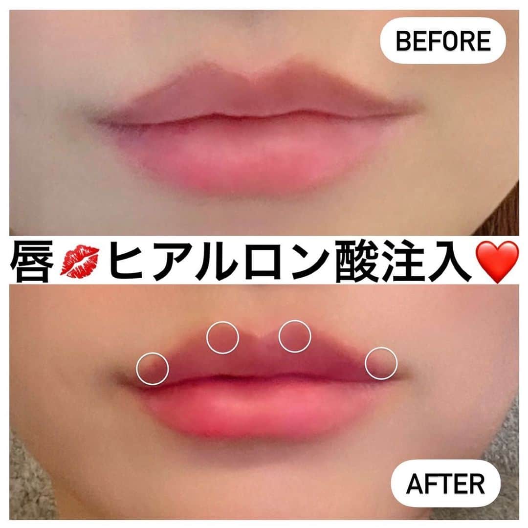 杉山佳那恵のインスタグラム