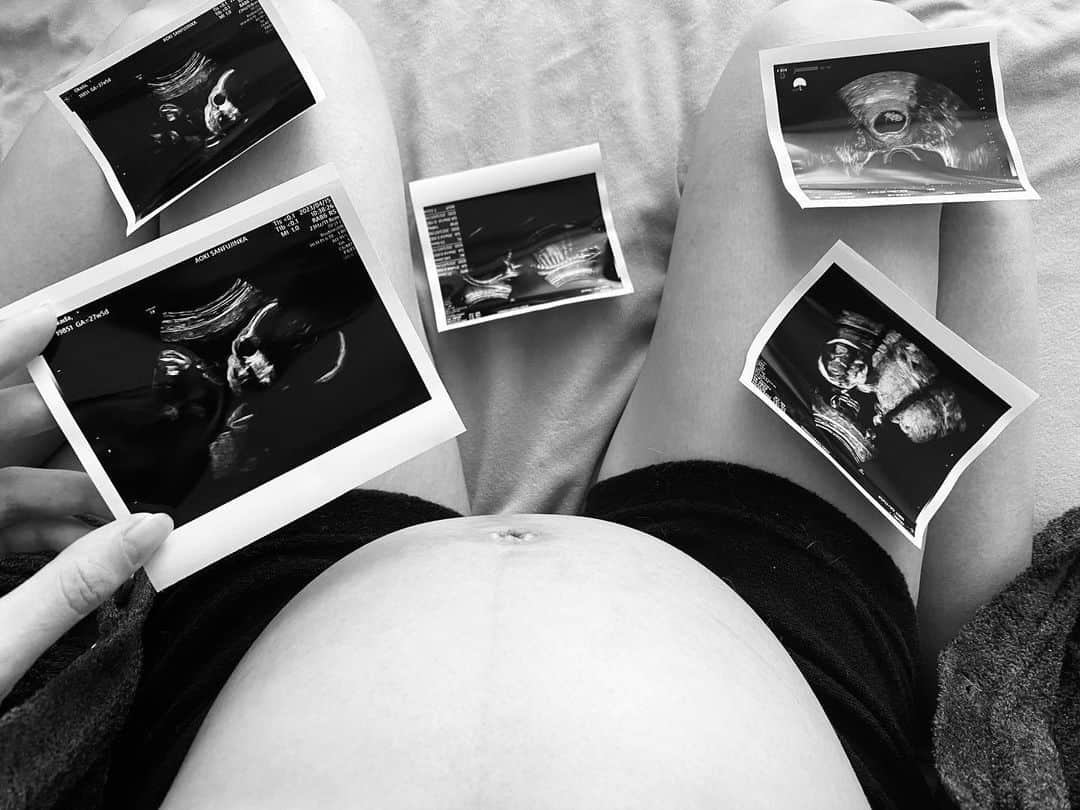 高橋菜生さんのインスタグラム写真 - (高橋菜生Instagram)「. We’re expecting a baby in July.👶🏻  #32w」5月12日 9時29分 - nao1118takahashi