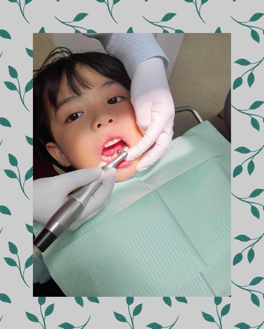恒松あゆみのインスタグラム：「食事中に「歯が痛い〜！」と、泣き出した息子。  ちょっと前の歯科健診では異常はありませんでした。 この短期間で虫歯という可能性は低そう。 奥歯が生えてきたから、その影響だろうと推測しました。  とはいえ、息子は初めての口内の痛みにショックを受けている様子・・・。  そうだよね。 ちょっと痛みの質が違うから、びっくりしちゃうよね。  というわけで、かかりつけの歯科クリニックに電話し、当日飛び込みで診察していただきました。  原因は、「6歳臼歯によって歯茎が盛り上がり、そこを噛んでしまっている」ことでした。  盛り上がり部分を切って取り除く方法はあるけれど、かなり出血するし、麻酔がきれた後はかなり痛むそうで・・・。  歯茎の盛り上がり自体はしばらくするとおさまるとのことで、このまま様子見することにしました。  歯のクリーニングをして、消毒をして、診察完了！  「生えてきてる歯のために、痛くても頑張る！！」 ・・・と決心した息子を見て、ちょっぴりじーんとしてしまったかあちゃんでした。  ちなみに息子は大の歯医者さん好き。 初めて行ったその日から「宇宙船みたい！」と、診察用のあの立派な椅子に惚れ込み、事あるごとに行きたがります。  全く嫌がらないので、親としては大助かりです😁   #6歳5ヶ月   #6歳臼歯   #テアトルアカデミー #子役 #モデル」
