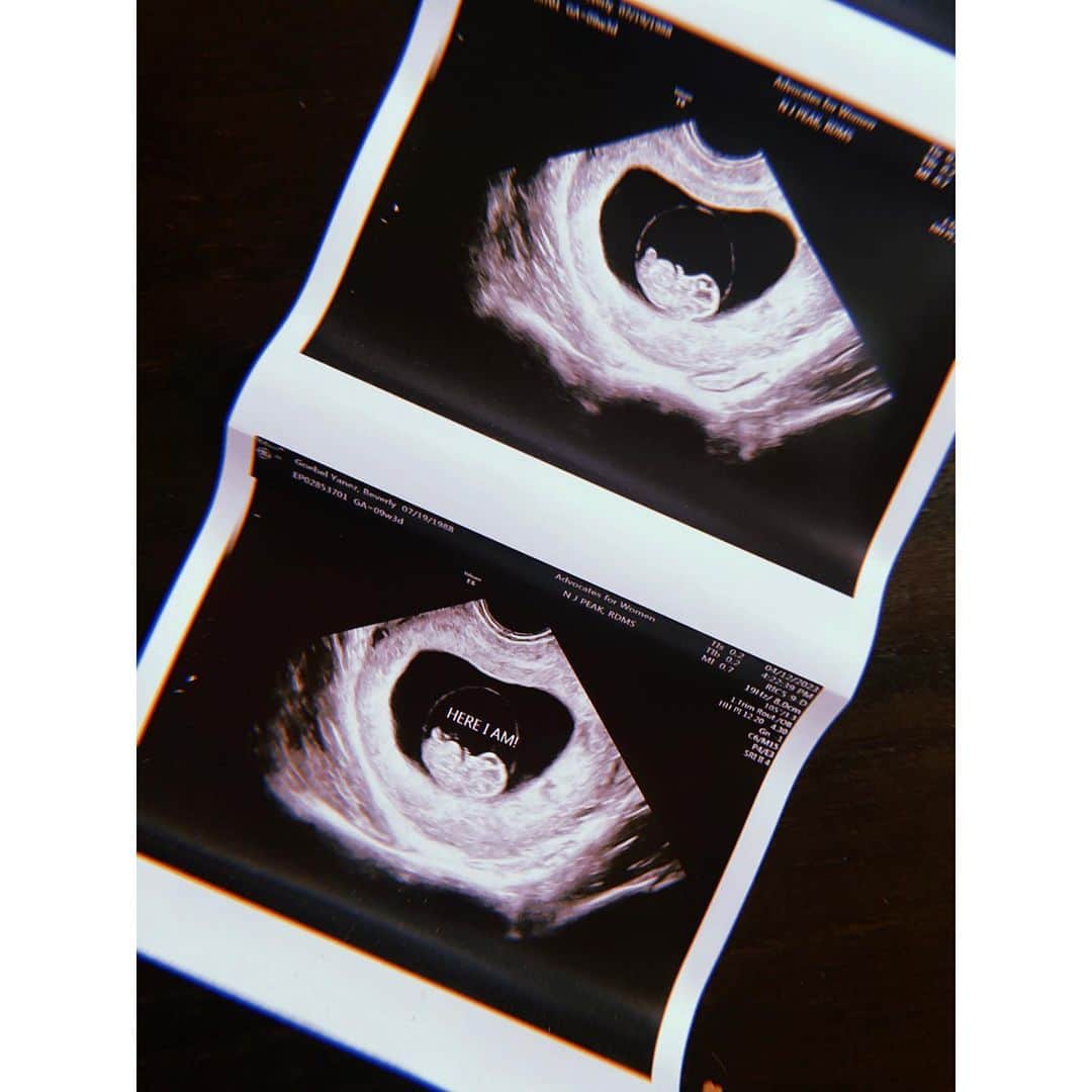 ベヴァリー・ゴーベル・ヤネズのインスタグラム：「Family of 4 coming soon…. 🥹」