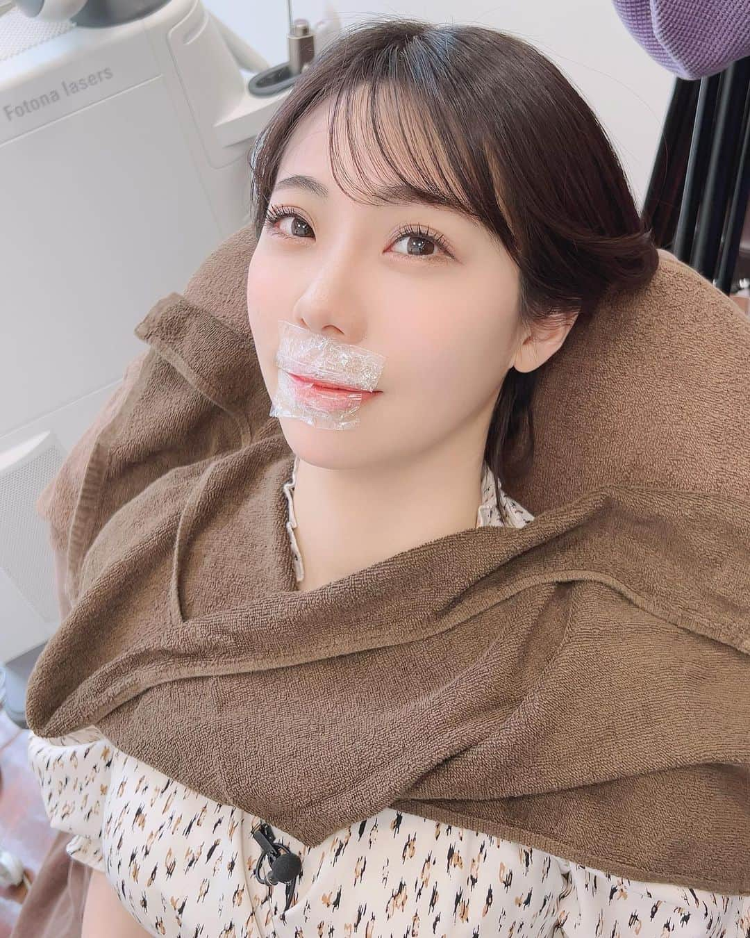 鈴木ふみ奈さんのインスタグラム写真 - (鈴木ふみ奈Instagram)「美研家 #4 は　@tokyototalbeautyclinic  さんにお邪魔してきました🧑‍⚕️  今流行りの人中短縮の施術を受けてきました😳😳 こんな施術があるなんて知らなかった✨  是非LINEで美研家をお友達追加して、毎週見てくれたら嬉しいです❤️‍🔥  撮影後にDr.Kubotaのクリーム、エッセンス、パックをプレゼントして頂いたのですが...  皮膚の専門家が作っただけあってめちゃ良い！！💗 医薬部外品として厚労省の承認を得ないと使用できない、トラネキサム酸が高配合されてるから美白にしたい方は良いかも🥰」5月15日 3時11分 - fuminasuzuki