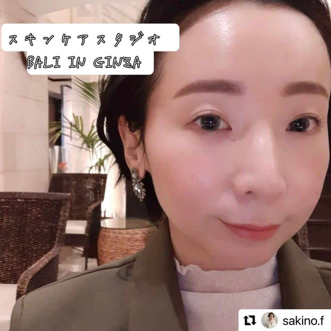 vs28baliさんのインスタグラム写真 - (vs28baliInstagram)「#Repost @sakino.f さま  施術の詳しい内容が詰まった素敵な投稿ありがとうございます‼️ 自分ではなかなかほぐしづらいあごまわりや口腔筋、首の疲れなどにもアプローチするプレミアムなコースです︎💕︎  ご予約・詳細はプロフィールのリンクをチェック🔗  ・・・ 過去の投稿はこちら→【@sakino.f】 _____________________________♡  マスク無しでも自信ある顔になれたよ❤️   今回体験したのは 【毛穴洗浄フェイシャルコース+マスクレスでも最強小顔！プレミアムオプションケア】約80分　通常価格34,100円～   @ebm_ginsta_gram 店で 施術して頂きました。   カウンセリングから対応に感動する✨ 肌年齢チェックマシンで写真を撮って 今の肌状態をきちんと説明。   私は【油分】が不足している 乾燥肌でした～   とことん肌悩みに寄り添ってくれるから もう、全部お任せしちゃいたくなる←  それを元にしっかり毛穴の洗浄。 赤くなったりしないし、吸引されてても全然辛くないの～ ミクロンレベルのミストを当て続けながら 肌に栄養を与えつつ 筋肉やツボを刺激。   最終的にはフワッフワな肌に仕上がった←   オプションは 顎の筋肉をほぐすマッサージと 首もとをほぐして 顔もリフトアップする工程。   外に流れていた顔が中心に集合←   こんなに違うものなのね。 マスクもそろそろ外す時間が長くなってきて ちょーっと自信ないってヒト   この投稿見たヒト →初回体験価格8,800円   全国に43店舗展開している スキンケアスタジオで施術出来るってよ～♪ 私も時間つくってリピートしようとしてる←  夏に向けて自分に自信つけたいヒト 是非行ってみてね❤️  @vs28bali   #スキンケアスタジオ #PR #イービーエム化粧品 #フェイシャル #毛穴洗浄 #美肌 #小顔 #マスクレスでも最強小顔 _____________________________♡   いつもいいね！👍コメント💬保存ありがとうございます♪   海外輸入品✈️ セレクトショップ始めました✨ プロフィールから飛べるので是非覗いて見てください♡   お気軽にフォローして貰えたら嬉しいです♪ @sakino.f ♡___________________________」5月16日 11時05分 - vs28bali