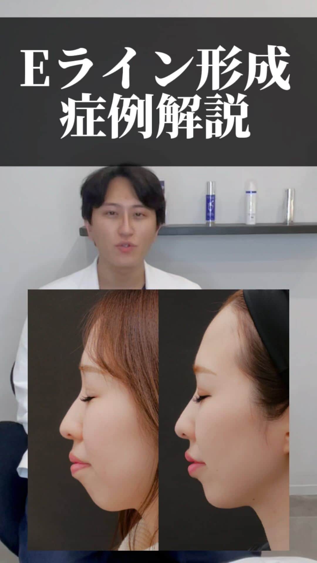 東京イセアクリニックのインスタグラム