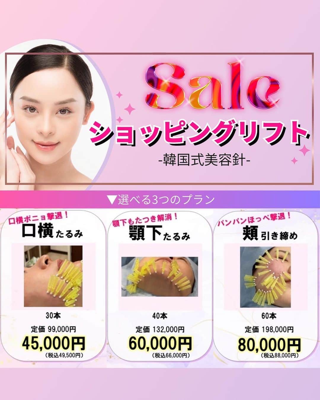 恵比寿フィラークリニックのインスタグラム：「ショッピングリフト試して欲しいからSALE！ １年間のコラーゲン生成で肌艶アップ✨  ショッピングリフト(韓国式美容針)は極細糸が付いた針を 挿入する事でコラーゲン再生を促進させます🪡  👇目的に合わせたプランがこちら👇 ①口横ポニョ撃退！《口横たるみ》 30本　定価 99,000円→キャンペーン価格  45,000円(税込49,500円)  ②顎下のもたつき解消✨《顎下たるみ》 40本　定価 132,000円→キャンペーン価格  60,000円(税込66,000円)  ③パンパンほっぺ撃退💥《頬引き締め》 60本　定価 198,000円→キャンペーン価格  80,000円(税込88,000円)  #フィラークリニック #ショッピングリフト #ショートスレッド #スレッドリフト #糸リフト #たるみ改善 #たるみ #たるみ治療 #たるみ解消 #口横ポニョ #頬のたるみ #頬肉 #引き締め #頬引き締め #顎下たるみ #二重顎  #韓国式美容針 #コラーゲン #ツヤ肌 #ツヤ肌メイク #艶肌 #肌質改善 #ハリツヤ #たるみマッサージ #小顔マッサージ #小顔ローラー #美容針 #毛穴 #リフトアップ #毛穴引き締め」