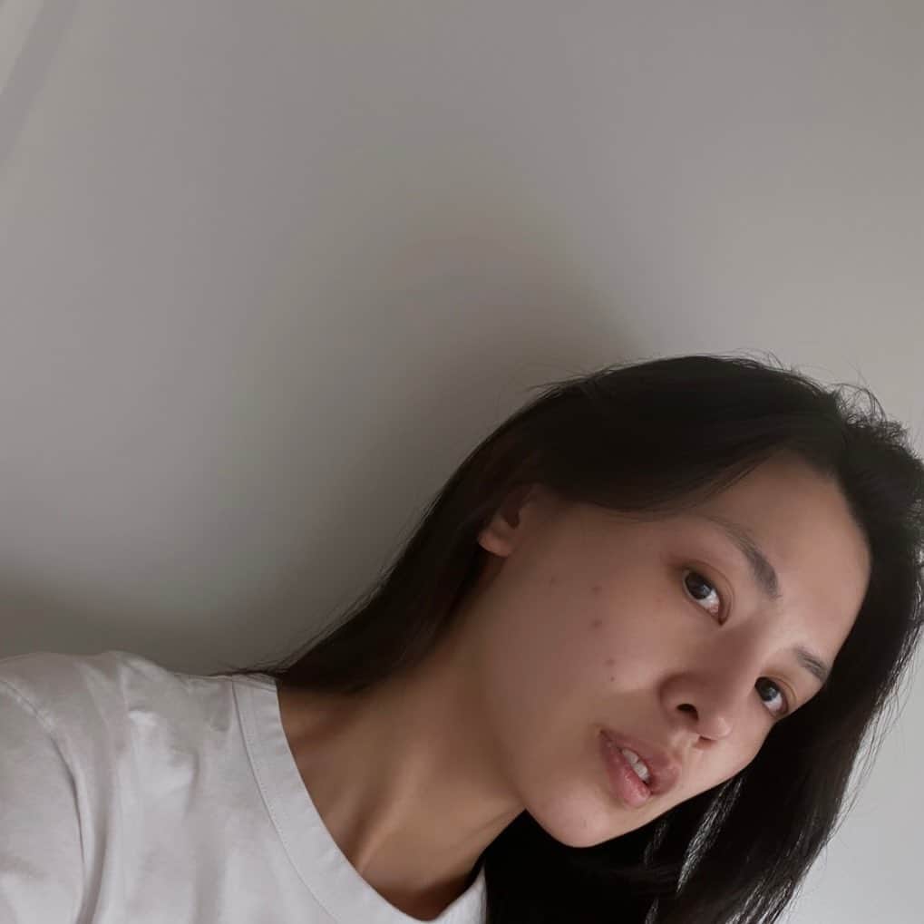 申真衣のインスタグラム：「北斗七星みたい、と夫が言ったニキビ達💫 そう言われるとちょっと愛しいような気もしたりして(いや早く治って 心や胃腸がゆらぐと肌に出るタイプです🫠」