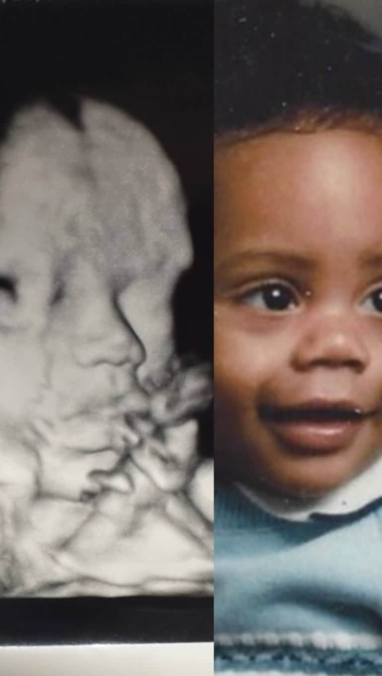 のインスタグラム：「(Turn your phone sideways) We’re keeping the baby’s gender a surprise until delivery! I feel a mix of nervousness, excitement, and humility. Either way, I think it resembles me as a baby! No? ❤️ #ShadTheFather」