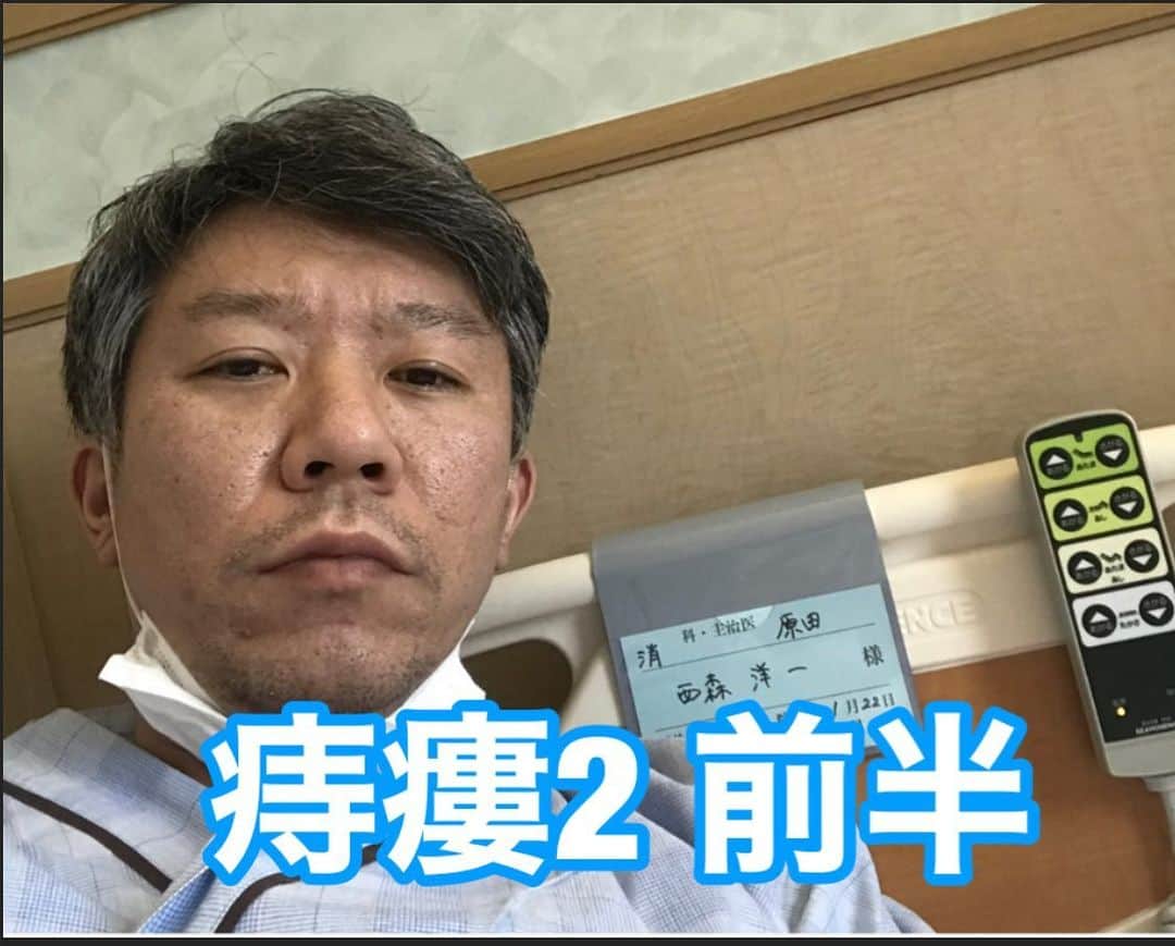 のインスタグラム：「☘2017.6.20『入院2日目』前半  今日は手術当日。　朝6時起床、9時、手術台の上へ。 、 怖かった、、。 人生を振り返ると、今まで.きっちりとした、手術室に入った事が無かった。 、 テレビで、よく見る感じの手術室。 、 下半身麻酔なので手術台の上へは、僕が自ら上がる。　死刑台に自ら上がる、海賊王の様だ。 、 お医者さん、手術器具、手術室、をセットで見た途端、心臓がギュっとなった。 『ホンマにするんですか？』と、言いそうにる。 この三点セットの破壊力は、並ではない。 、 何故か、バンジージャンプを飛ぶ前と同じ感覚になり、混乱した。 、 断われる訳もなく、自ら台に乗る。 、 大蛇に腕を噛まれる怖さ、に比べれば、まだ我慢出来た。　ジャッジ洋一のおかげだ。 嚙まれといて良かった。　いや、ええわけない。 、 そして、直ぐに麻酔。　腰の背骨と背骨の間に､麻酔を打つ。　　怖過ぎる。　　 刺すところ見てないけど、怖すぎる。 、 ♦︎他にも、刺されたら嫌な所。 、 わき、、絶対にいや！　 、 指と爪の隙間、、絶対にいや！ 、 目、、ギャ〜〜〜〜〜〜。 、 その後、分娩台に似た台に自ら乗る。 出産の時とは反対向きの「うつ伏せ」で足を開き、 固定される器具だった。 、 なので……豪快に「ちんこ」丸出し。 、 私はいったい……何回.人前でチンコ丸出しになるのでしょう。  銭湯でもない所で、いったい何回なるのでしょう。 、 死ぬまでに何回なるのか、先に教えといて貰えないでしょうか。 、 この時点で、ここにいる､7人ぐらいの人達全員に「モンスターエンジンの西森」とバレている。 、 最悪だ。 、　 皆んな、俺のちんこに対して、何の感想もなし。 、 『あれ？　今日は、付いて無かったかな？』 と、思わせる程、僕のちんこを無視。 、 『よく剝けてますね』ぐらい言うてくれても良かった。 『ええまぁ、遺伝ですわ！』ぐらい返した。 、 しかし……怖すぎて恥ずかしい感覚も薄れる。 よく考えると、どこも海賊王じゃなかった。 死刑だとしたら『なに､この殺し方？』となる。 、 僕の症状は、痔瘻の中でも厄介な「1000人に1人」の複雑痔瘻だ。 オペは、かなりの時間を要する。 、 初老男性の執刀医も言っていた。 『少し手間取りましたね』 、 、 全部で「18分」かかった。 、 はやっ！。 、 それでも、長かった方らしい。 さすが、関西に２人しかいない「ゴッドハンド」だ。 、 ベットのまま病室へ移動。　看護師さん、三人がかりで押して貰った。 「その為にベット細かったんや……」と、どうでもいい事に納得。 、 全く歩けない、怖さときたら。 、 仰向けのまま、6時間安静。　術後すぐは、下半身の感覚ゼロ。 　 、 怖すぎる。 、 後半に続く……。」