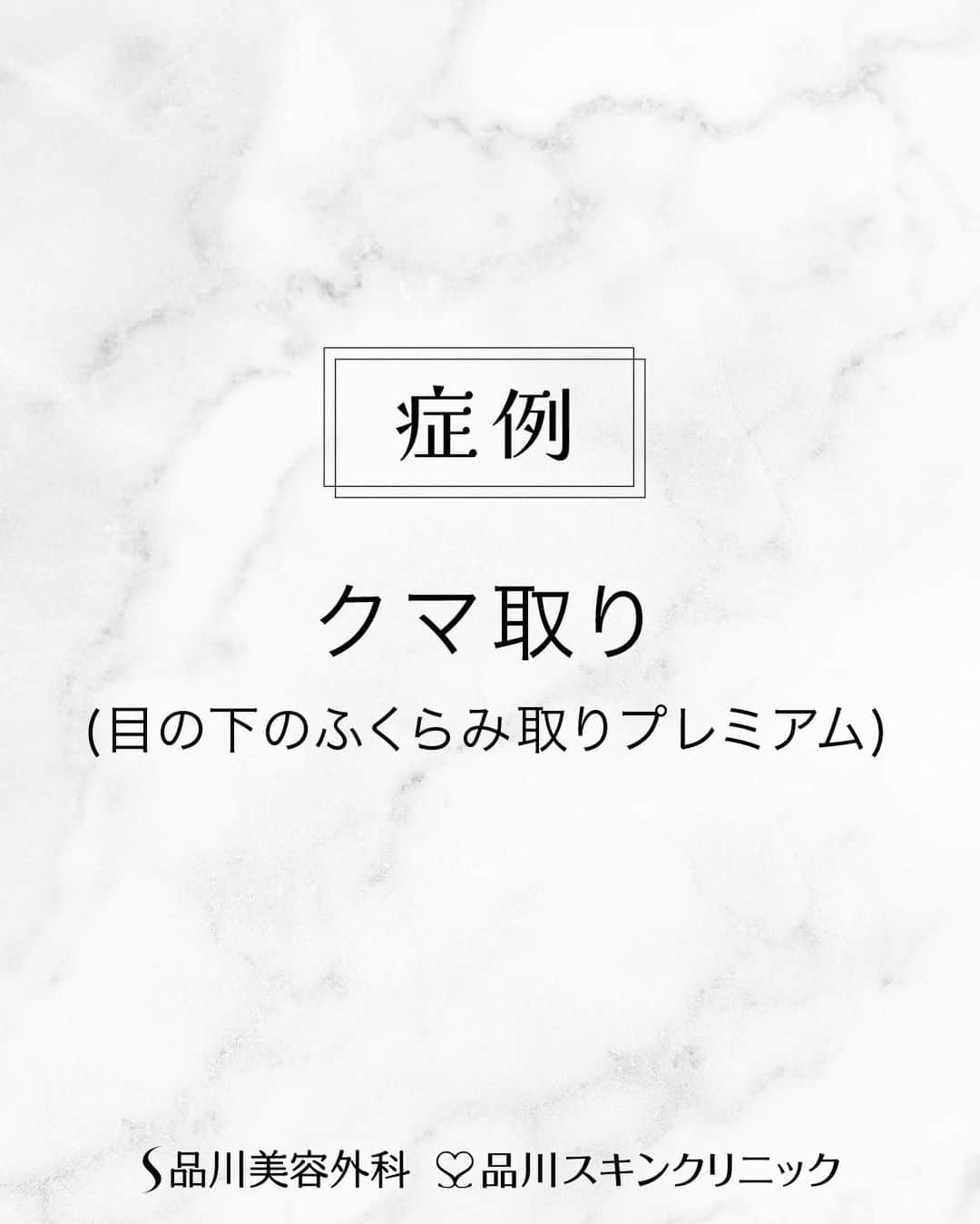 品川美容外科【公式】のインスタグラム