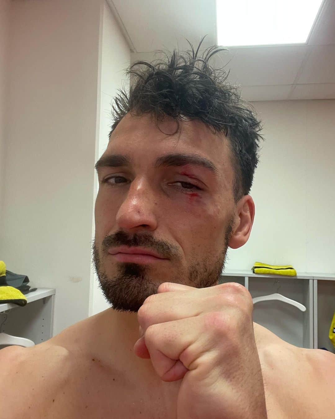 マッツ・フメルスのインスタグラム：「Worth it 🖤💛   90 Minuten noch!」
