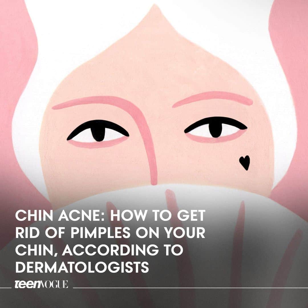 Teen Vogueのインスタグラム：「Say bye to the chin breakouts! Tap the link in bio for tips on getting rid of chin acne according to dermatologists✨  (🎨: Gabriella Cetrulo)」