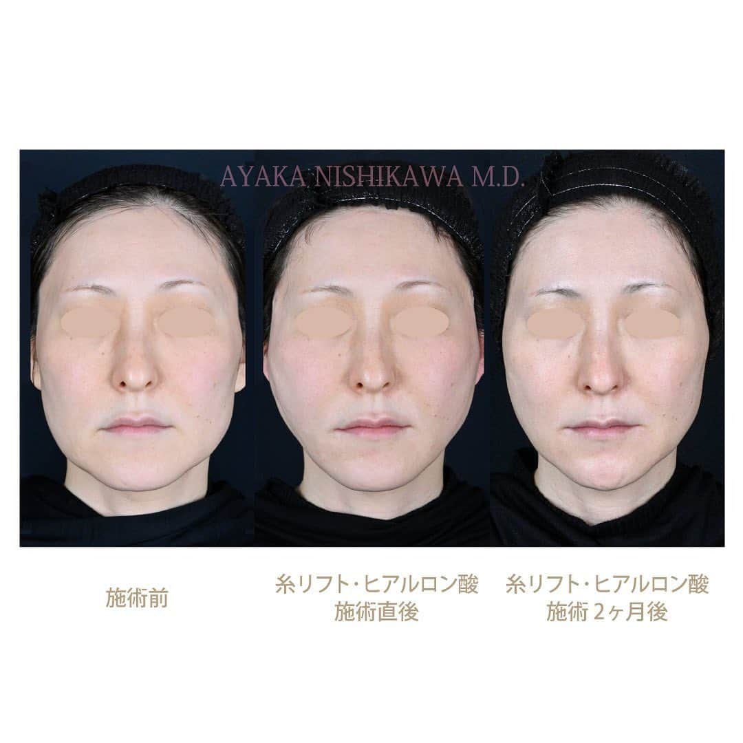 西川礼華のインスタグラム