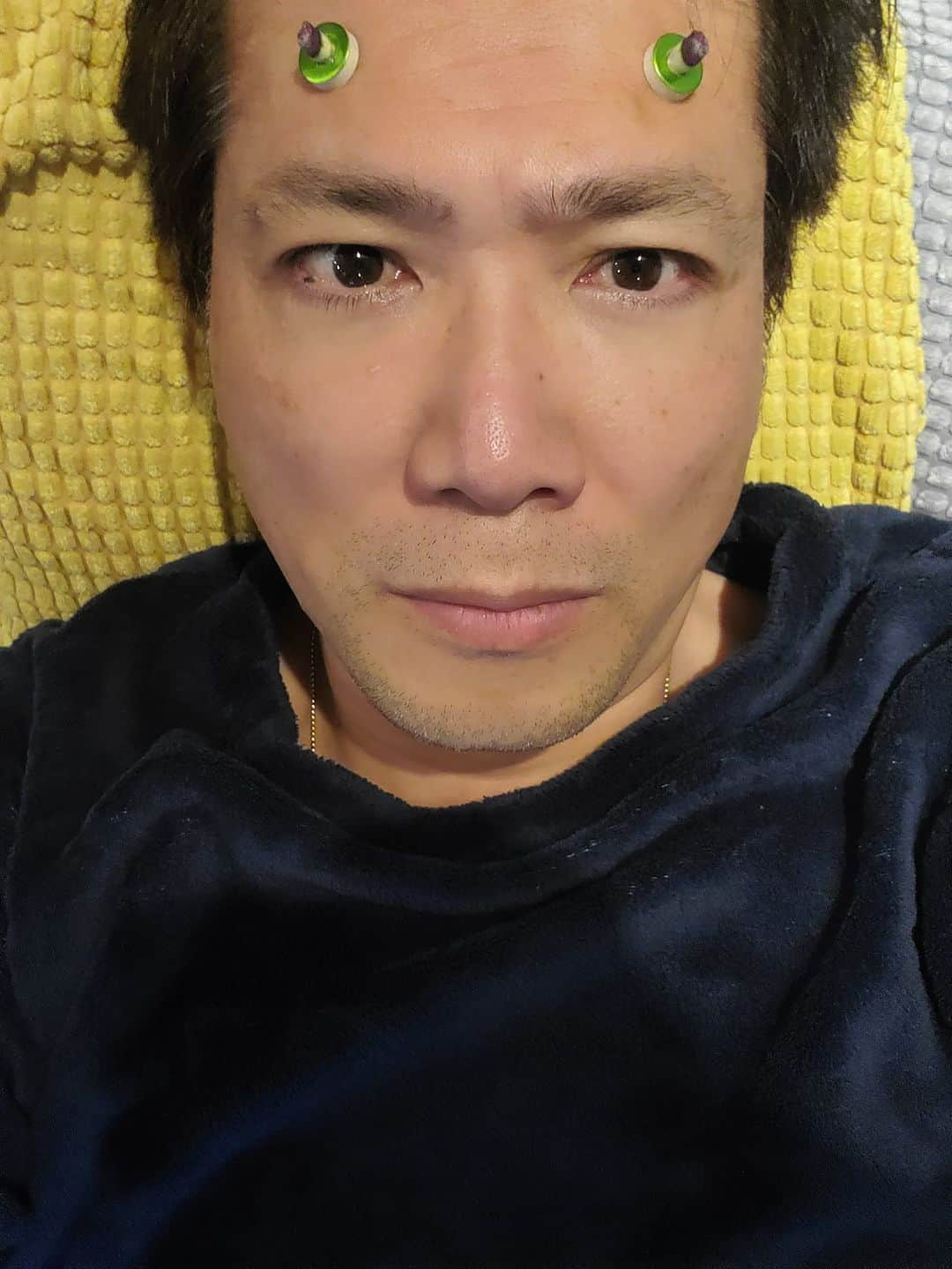 別所哲也さんのインスタグラム写真 - (別所哲也Instagram)「お灸で、整えよう。」5月23日 21時07分 - tetsuya_bessho