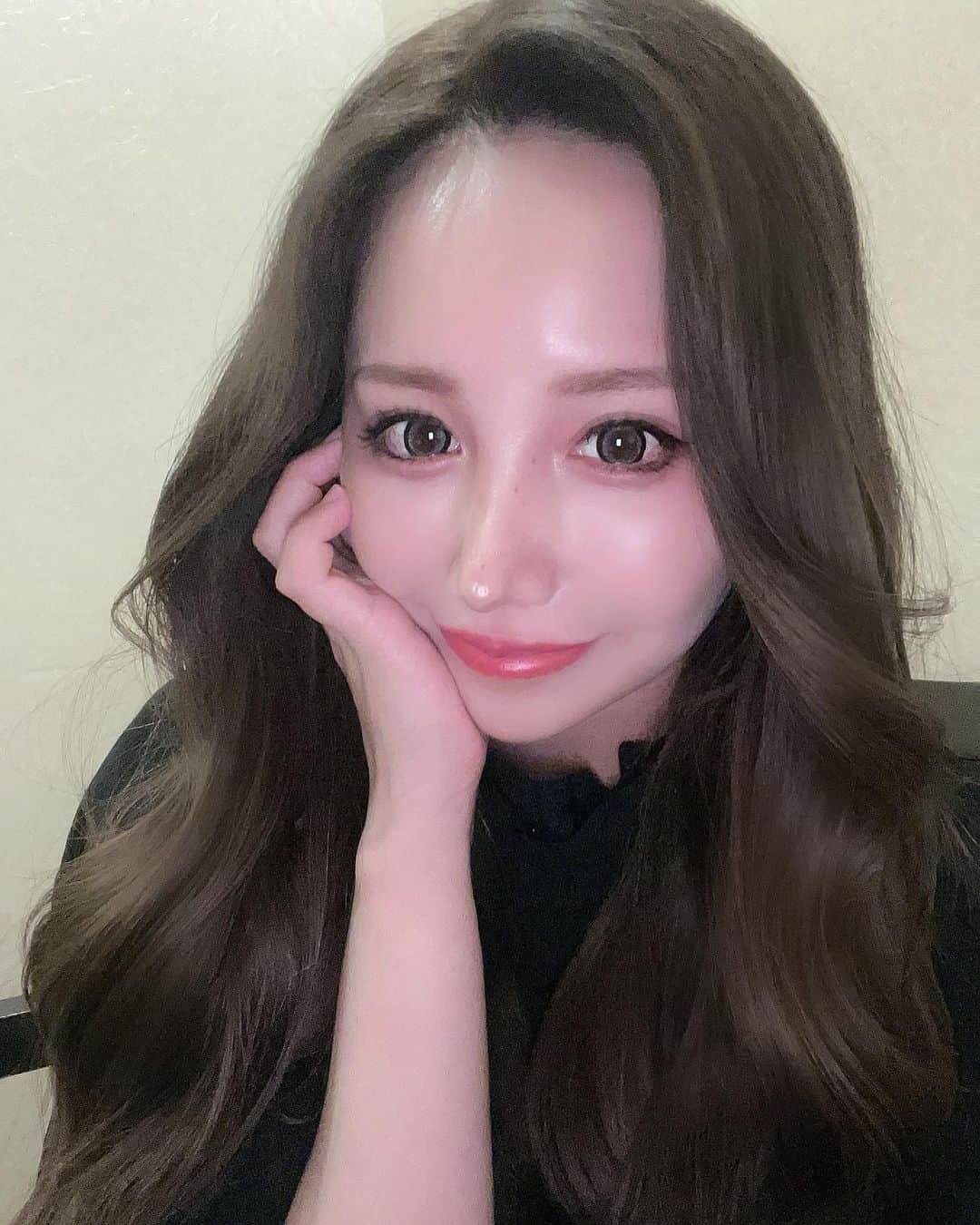 のインスタグラム：「. 雨降ったり止んだり忙しい1日だ☔️🐶  この前しおん先生に会いに行ってきた👭✨ ほんと見た目も性格も可愛い🥺🩷 女優注射で目の下の小皺とほうれい線の 浅いシワ治療したよ😎✨ 小皺治療とか毛穴や お肌にハリが欲しい人にもおすすめ♪ 詩音先生は将来のことも考えて 必要なものそうでないもの やってはいけない物を的確に教えてくれるから 美容で不自然になりたくない人や 美容初めての人にも家族や友達にも おすすめできる先生だよ🥰 あとは二重整形が上手で有名だから もしやる時は詩音先生にお願いする🐶💐 . #女優注射　#新宿」