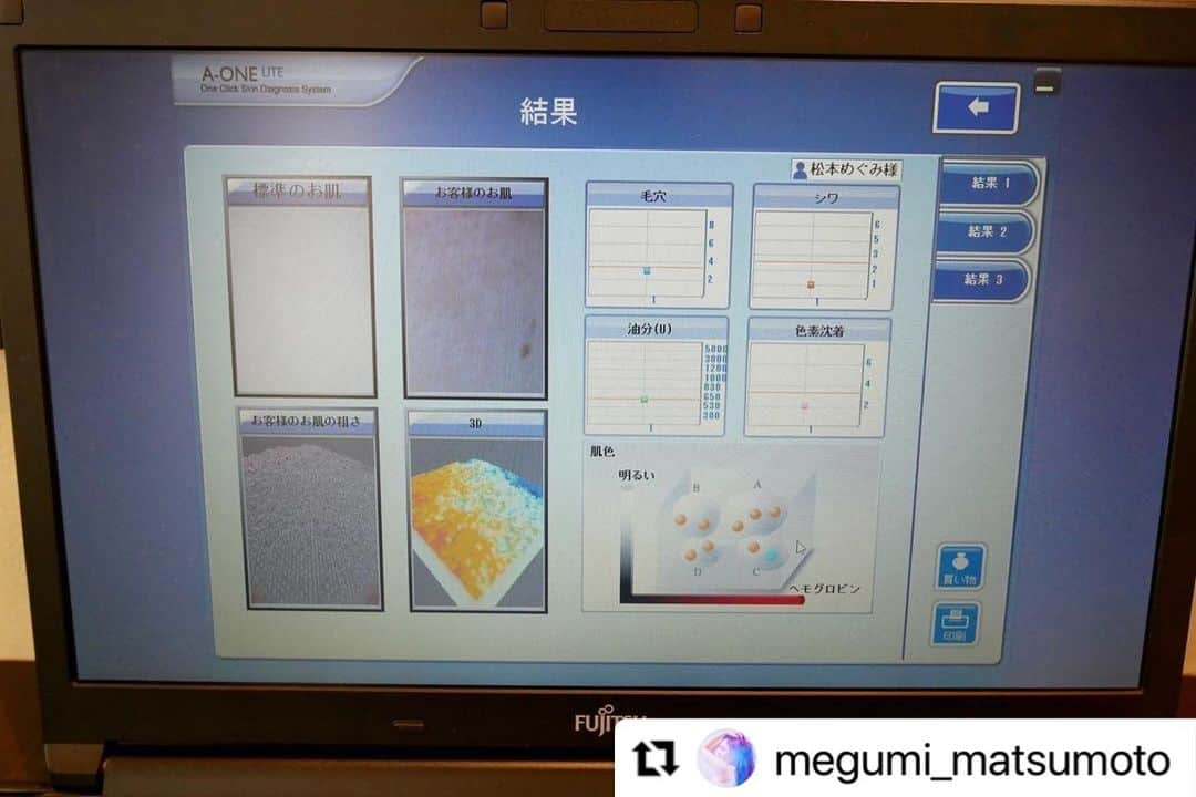 vs28baliさんのインスタグラム写真 - (vs28baliInstagram)「#Repost @megumi_matsumoto  さま  素敵な投稿ありがとうございます✨ 施術の様子がよくわかります👍  夏を迎える前に、肌のお悩み一掃しましょう💪  ご予約・詳細はプロフィールのリンクをチェック🔗 ・・・ マスクなしでも自信の素肌&最強小顔と噂の「毛穴洗浄フェイシャルコース&プレミアムオプションケア」を初体験❗️  お伺いしたのは、基礎化粧品会社EBMが展開する、VS28スキンケアスタジオBALI IN 銀座😊 海外のリゾートのような雰囲気で、清潔感もあり、接客も丁寧で安心してお任せできました🙌  まずは、お肌の状態を写真を撮ってデータ化し、丁寧にカウンセリング💻  🔹クレンジング&オイルトリートメント 🔹天然活性水スチーム 微粒子化したスチームを当てて化粧水約1本分の潤い補給 🔹毛穴吸引 毛穴の黒ずみや汚れを吸い出します 🔹毛穴洗浄&角質除去 🔹リフトアップ&肩・首トリートメント ミネラルクリームでマッサージ 🔹口腔筋集中トリートメント 凝り固まった部分を入念にほぐします 🔹美ラインネックエイジングケア 首元をマッサージしながら伸ばします 🔹ABA浸透保水 🔹天然保湿パック&セラミド保湿 ハンド・フットリラックスケアも付いた、オールハンドで行われる贅沢なコース❤️  施術後は、お肌が生まれ変わったようにツヤと透明感が出て、手触りがツルツル✨ マスク荒れで赤みが気になる部分も落ち着きました🤗 何より驚いたのが、顔のむくみと弛みが取れてフェイスラインがスッキリしたこと‼️ 一回の施術で、かなり印象が変わるので継続して通いたいな〜💆‍♀️  念入りにマッサージしてもらったおかげで、日頃の疲れが取れて、極上のリラックスタイムでした💕  お得なキャンペーンのお知らせ🎶 今回体験した 【毛穴洗浄フェイシャルコース+マスクレスでも最強小顔！プレミアムオプションケア】約80分 通常価格34,100円～ →初回体験価格8,800円  全国に43店舗展開しているスキンケアスタジオにてお受けいただけます  📍VS28スキンケアスタジオBALI IN 銀座 東京都中央区銀座5-10-6 御幸ビル6F  @vs28bali  #スキンケアスタジオ #PR #イービーエム化粧品 #フェイシャル #毛穴洗浄 #美肌 #小顔 #マスクレスでも最強小顔 #エステ #aesthetic #salon #サロン #エステサロン #エイジングケア #リフトアップ #コルギ #骨気 #マッサージ #小顔矯正 #massage #healthcare #facialcare #フェイシャル #beauty #美容 #美容好きな人と繋がりたい #スキンケア #毛穴 #毛穴ケア #銀座」5月25日 14時40分 - vs28bali