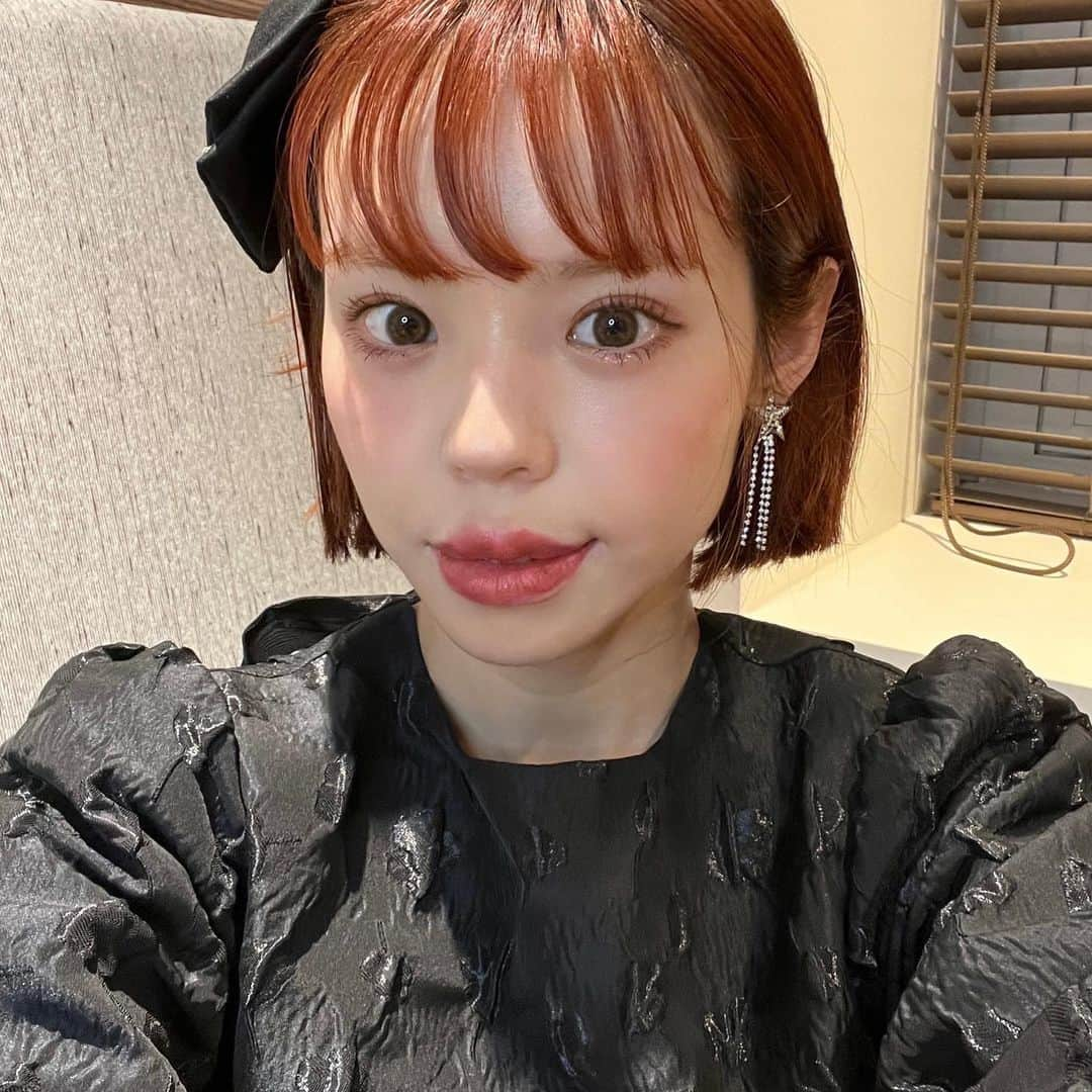 瀬戸あゆみさんのインスタグラム写真 - (瀬戸あゆみInstagram)「30歳から、自分の気に入らないところがあれば、どんどんアップデートする！を、テーマに生きてます。 それは自分の見た目も中身もそう。  見た目の場合は、じゃんじゃん美容で補っていきます。✨ 自分をきらいになるのだけは嫌だから。 その努力は惜しみたくない。  @lor_dr_riki 先生に前回肩ボトックスの相談をしたタイミングで、実は、唇のコンプレックスも伝えていて。 1番最後に載せたのですが、昔から、左右の厚みが違うのが、コンプレックスでした。 口が曲がって見えてしまう、だから、写真でも真正面の顔をあまり撮らなくなってた😕  そんなことをカウンセリングの時に先生に話したら、唇にヒアルロン酸を入れて均等にすること、更に口角にボトックスを打って、口角を上がりやすくさせること、を、おすすめしてもらいました！  元々は唇がうっすいアヒル口のような顔がすきだったのですが、わたしは唇が分厚くて、さらにボリューミーになるんじゃないかと懸念していたのですが、先生のセンスを信じてその通りにお願いすると、左右の差がわかりづらくなり、立体的な唇…今の自分の顔、けっこうすき🥰 そして、涙袋もすこーしだけ、厚みを出してもらった🥹🩵  いまでは毎日、写真を撮ったりメイクをしたりするのが楽しいです！  りき先生は、やった方がいいものとやらなくてもいいもの、すごく正直に色々と見定めてくれるから、特に何も決めずにカウンセリングに行くのもおすすめだよ🍒 もう2ヶ月以上前のことで、誰かから気づかれる！とかはないのだけど、やっぱり自分が毎日楽しくなるから、アップデート楽しくてやめられない😀 美容だいすき！  #lorclinicomotesando #ayumi_recommendation」5月27日 21時14分 - setoayumi