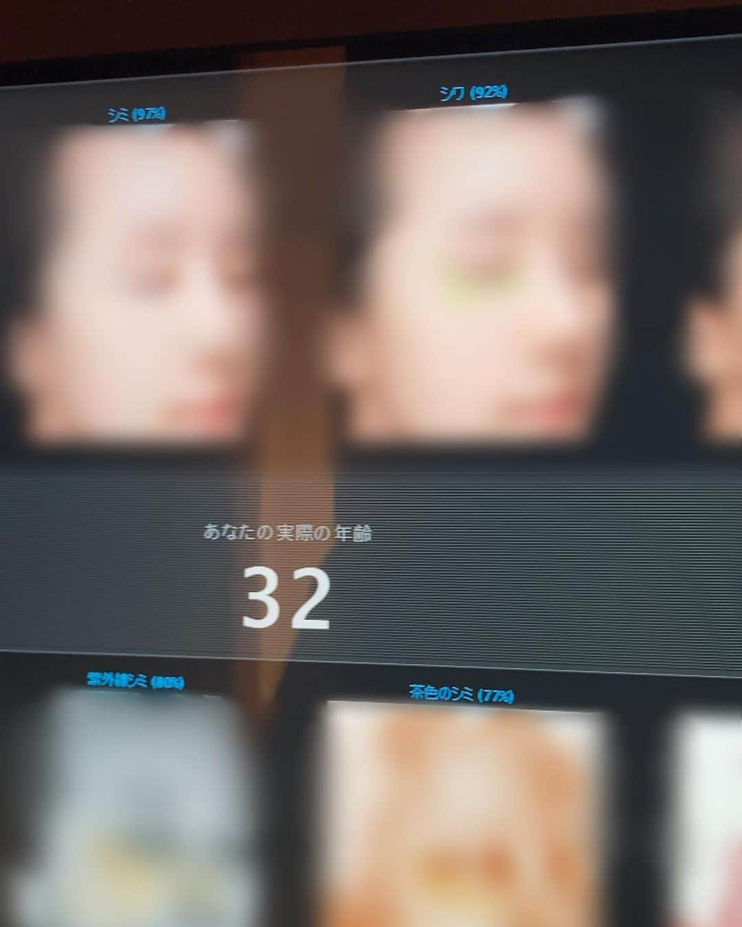 道重佐保さんのインスタグラム写真 - (道重佐保Instagram)「1年ぶりのVISIA肌診断！現在の年齢32歳、そして肌年齢は23歳でした🤲  パーセンテージが高いほど点数がいいそうです！キメが98％！100点満点中98点ということですね✌️  前回は-10歳(31になる直前に21が出ました✨)だったのでちょっと惜しい……でも気をつけてきてよかった〜！  パーセンテージ的には前回そして前々回より良くなっていて、肌年齢はキープしてるかちょっと年齢が上がっているか、 ということはですよ？何十万人のデータ平均値から判断しているvisiaですが、結論、前よりも良くなっているということなのかなと、、、 など勝手にポジティブに分析するのが好きなのですが……実際どうなんやろう？ 有職者の方、教えてください……  追記： 教えていただけました！！！😳🙌 この肌診断機VISIAは最大で今の年齢-9歳なんだそうです やから肌年齢はこれ以上は低く出ないし、前より点数が良くても年齢は上にでたのか〜と納得✏️  何はともあれ、これからもケア頑張ります🤲🤍🧖🏻‍♀️  #診断結果はすっぴん丸出しなのでぼかしてあります🙏🤣  #visia #肌診断 #肌年齢 #美容皮膚科 #美容オタ #portrait #japanesegirl #ig_japan #followme #iphone撮影 #4kvideo #人像攝影 #健康美 #彼女 #日本的 #道重佐保 #michishigesaho」6月27日 11時48分 - sahomichishige